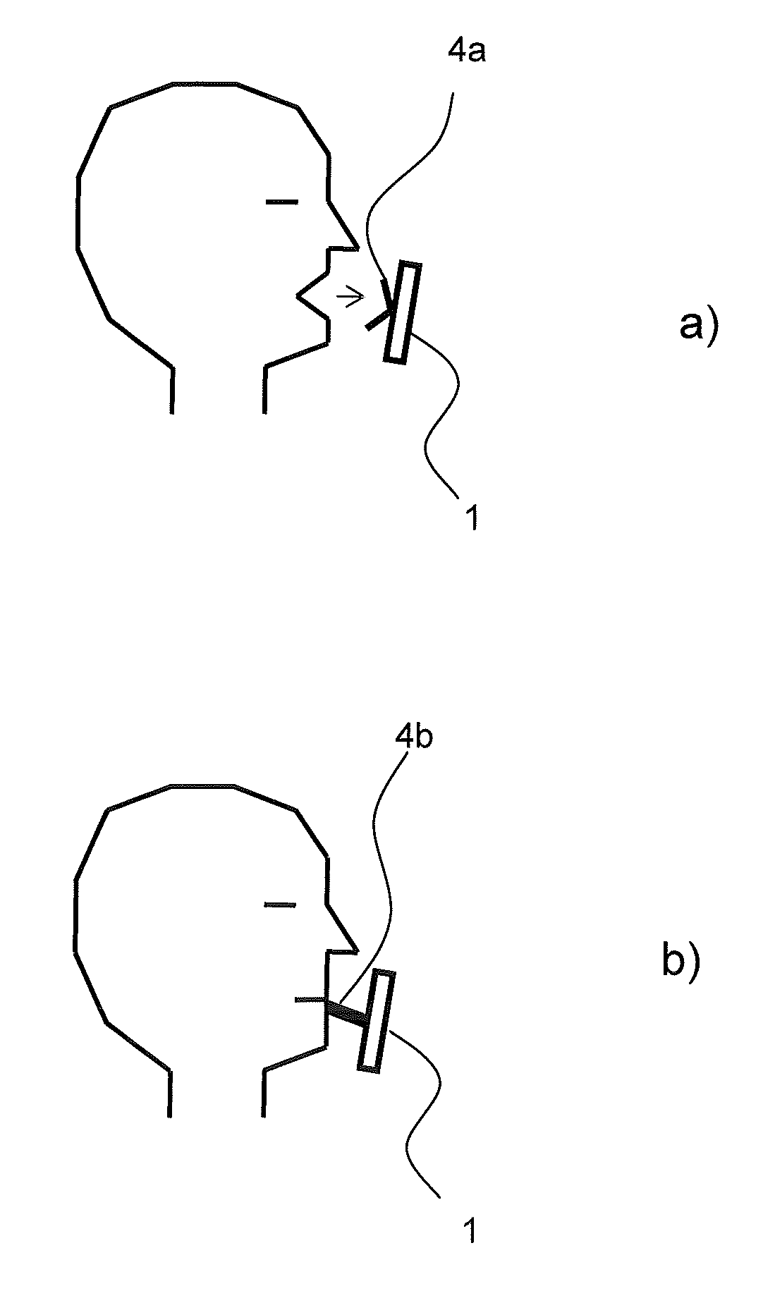 Multifunctional breath analyzer