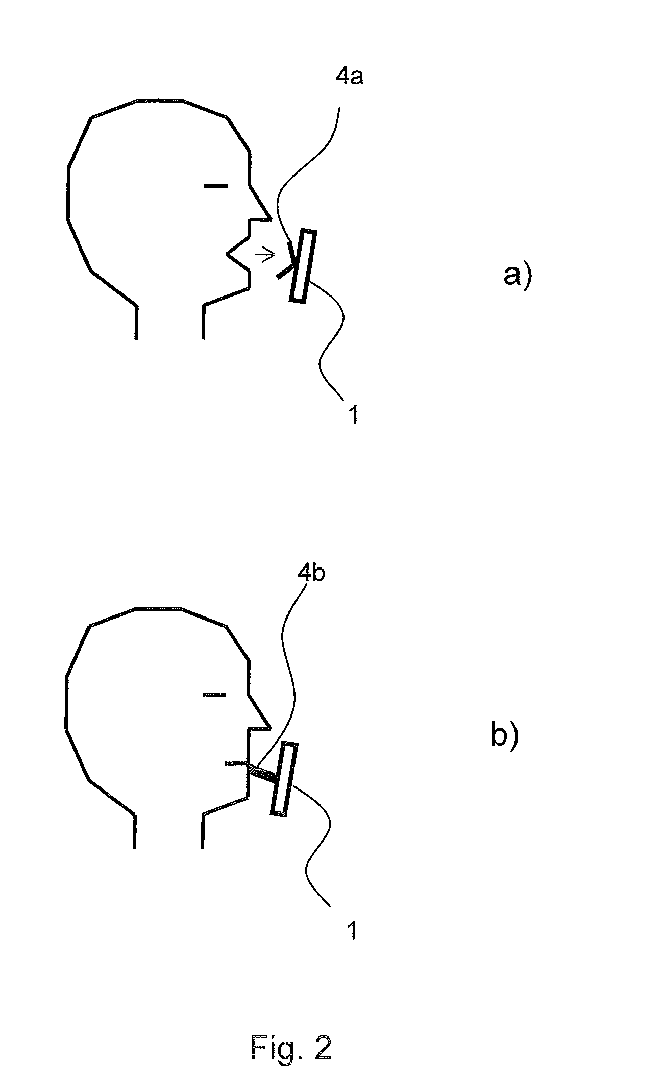 Multifunctional breath analyzer