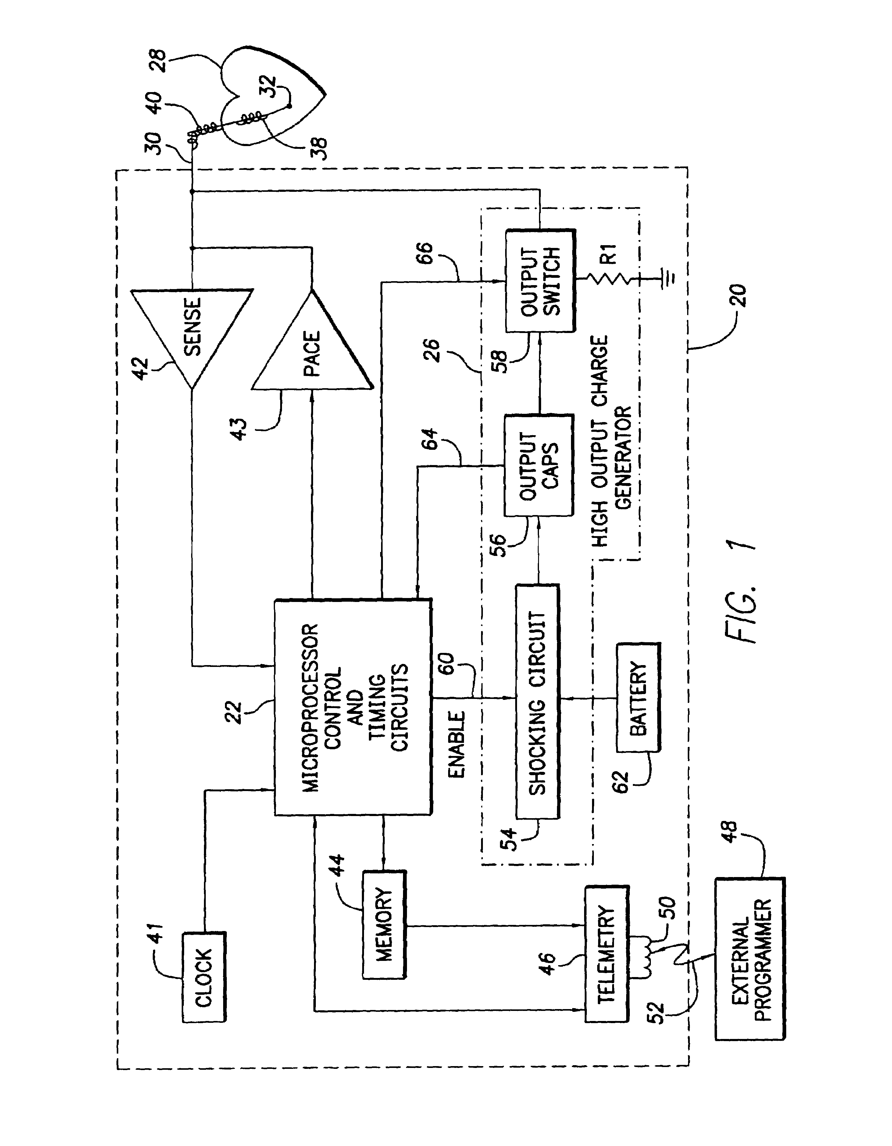 Implantable cardiac device for and method of monitoring progression or regression of heart disease by quantifying morphological features