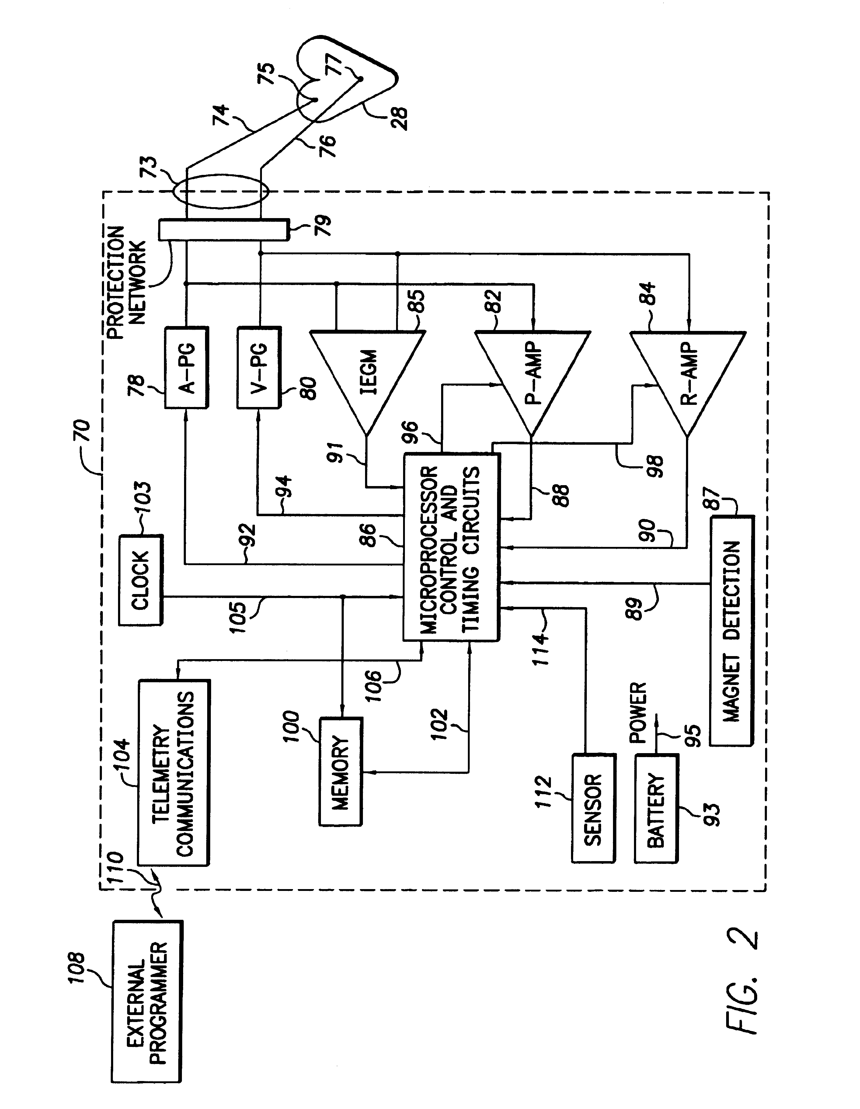 Implantable cardiac device for and method of monitoring progression or regression of heart disease by quantifying morphological features