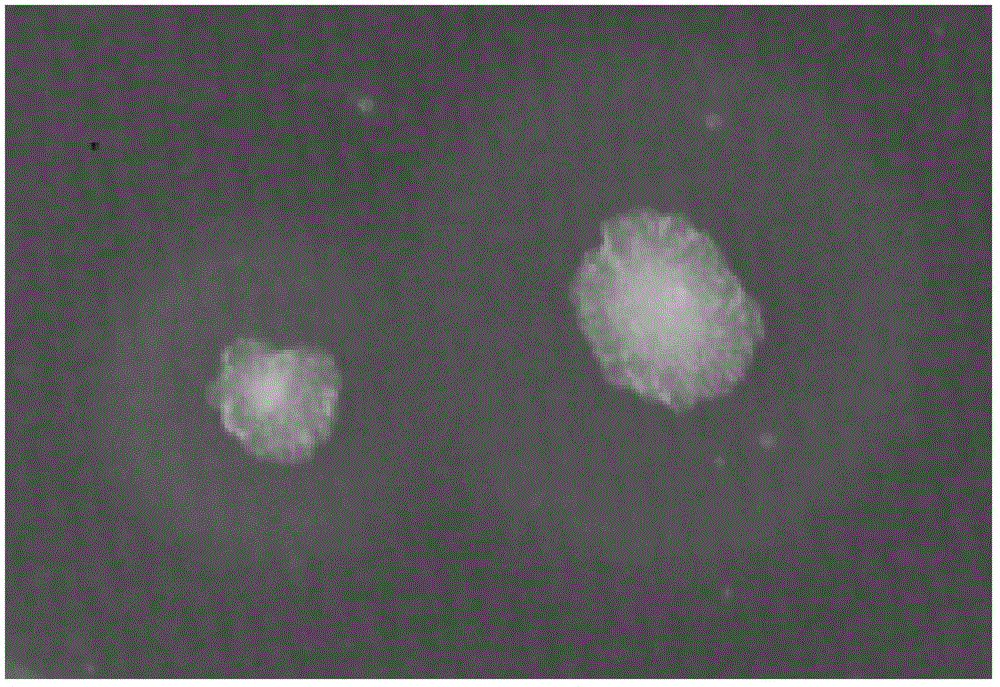 Strain for nattokinase with high activity and thermal stability and fermented product thereof