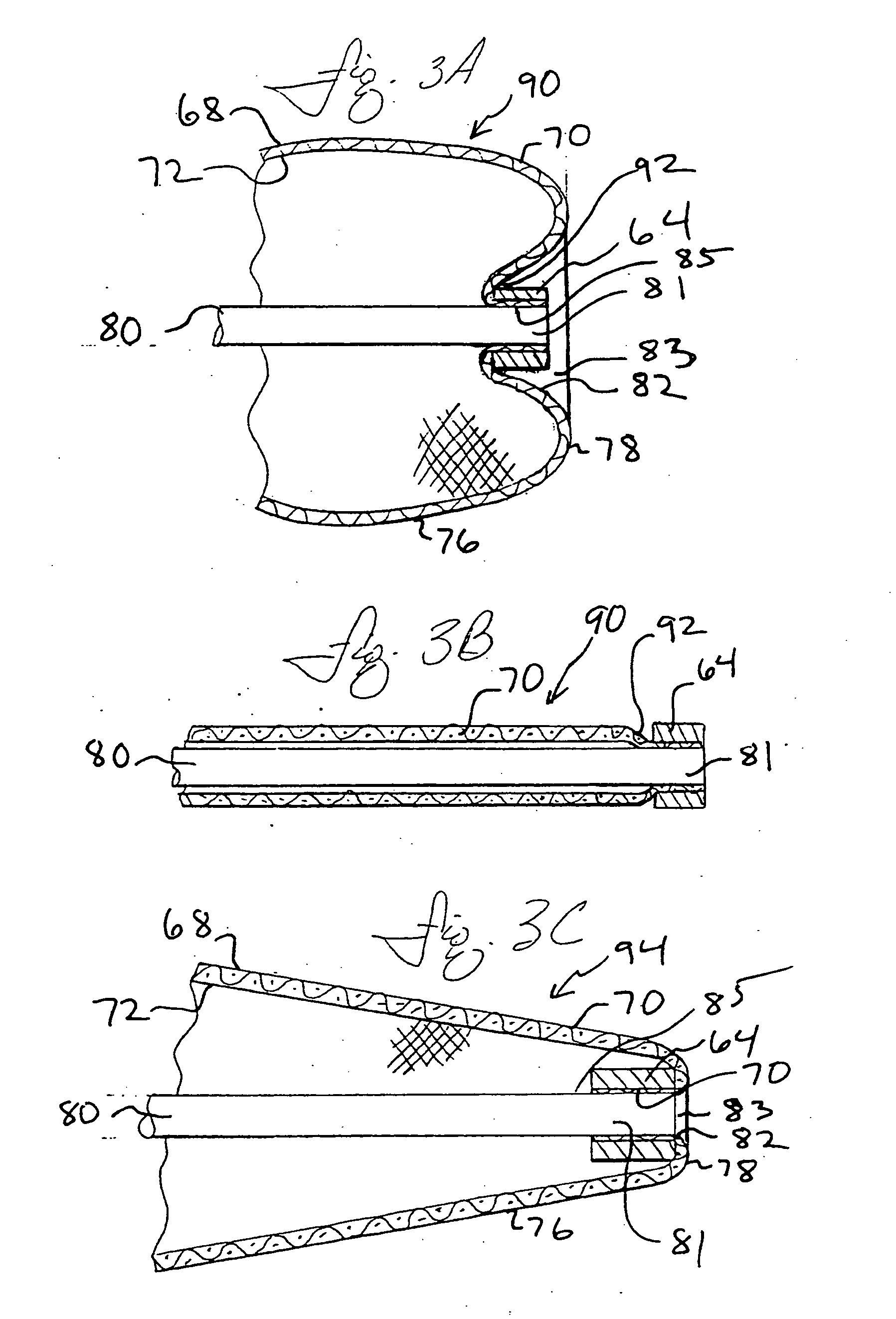 Everted filter device