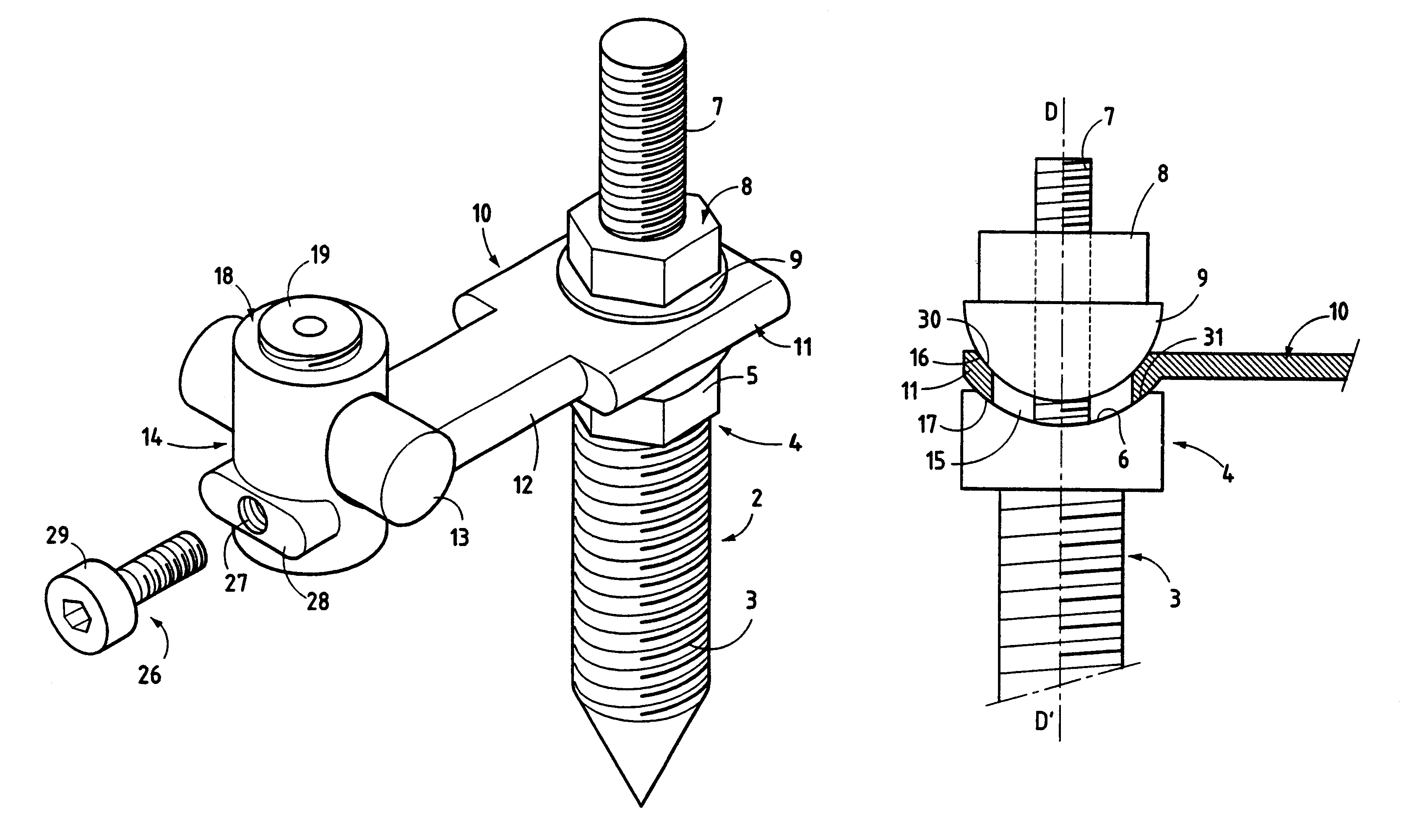 Connection device for osteosynthesis