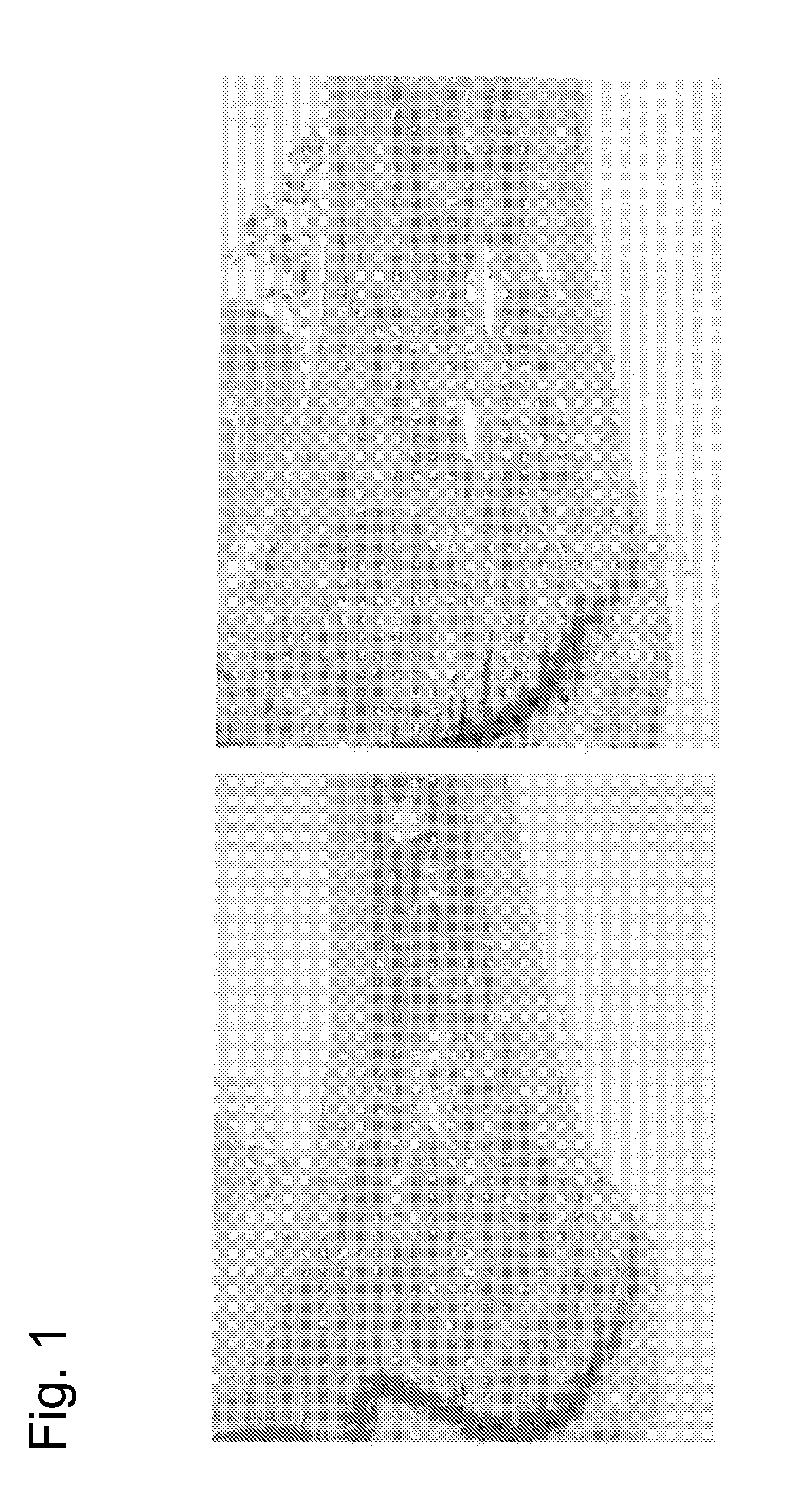 PHARMACEUTICAL COMPOSITION FOR TREATING BONE DISEASES WHICH COMPRISES PROTEIN COMPRISING Frizzled1, Frizzled2 OR Frizzled7 EXTRACELLULAR CYSTEINE-RICH DOMAIN