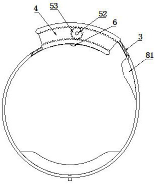 Femoral arteriovenous intervention postoperative compression hemostasis device