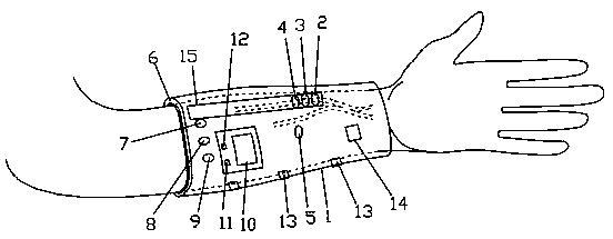 Multifunctional wristband for monitoring internal arteriovenous fistula of hemodialysis patient