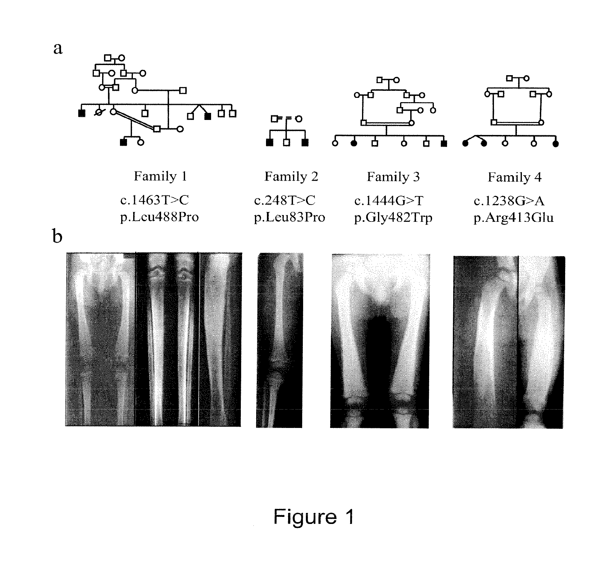 Methods for the treatment and diagnosis of bone mineral density related diseases