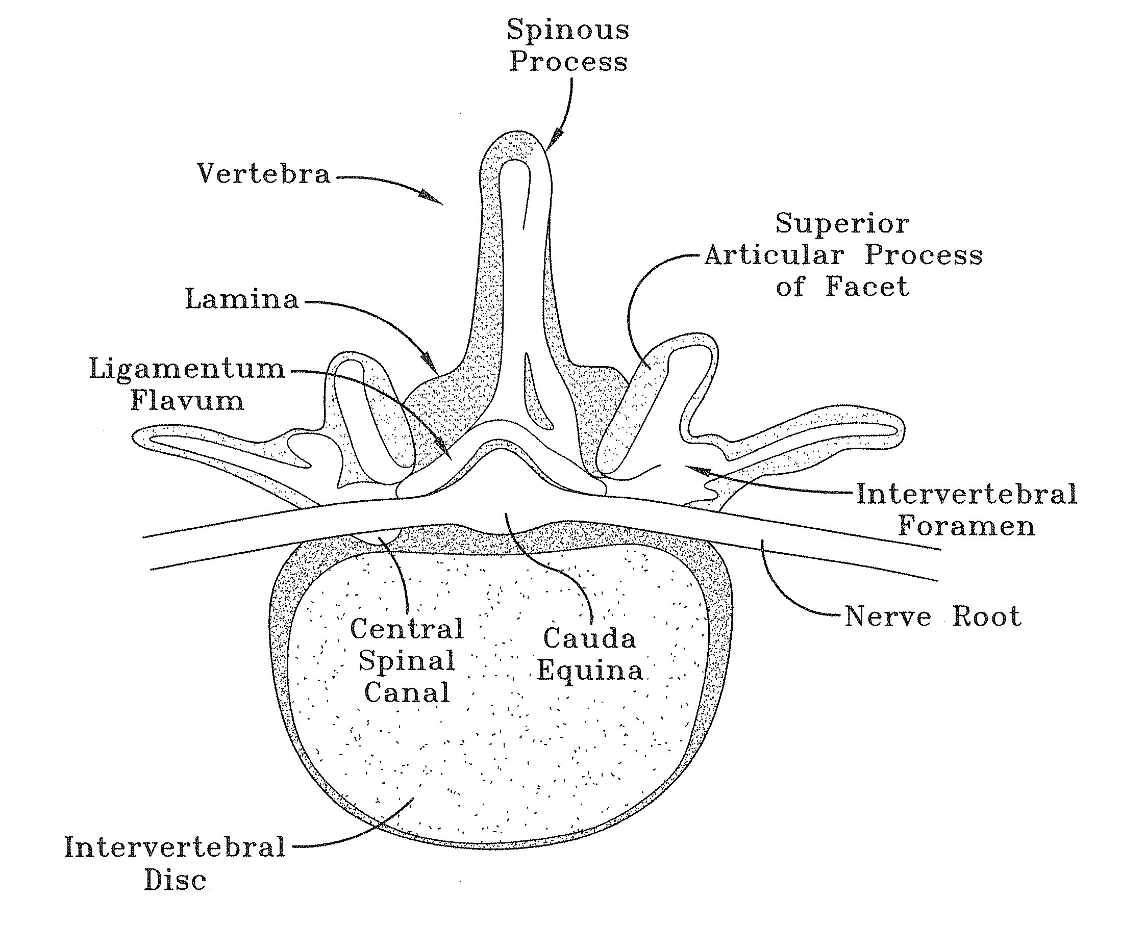 Orifice probe apparatus and a method of use thereof