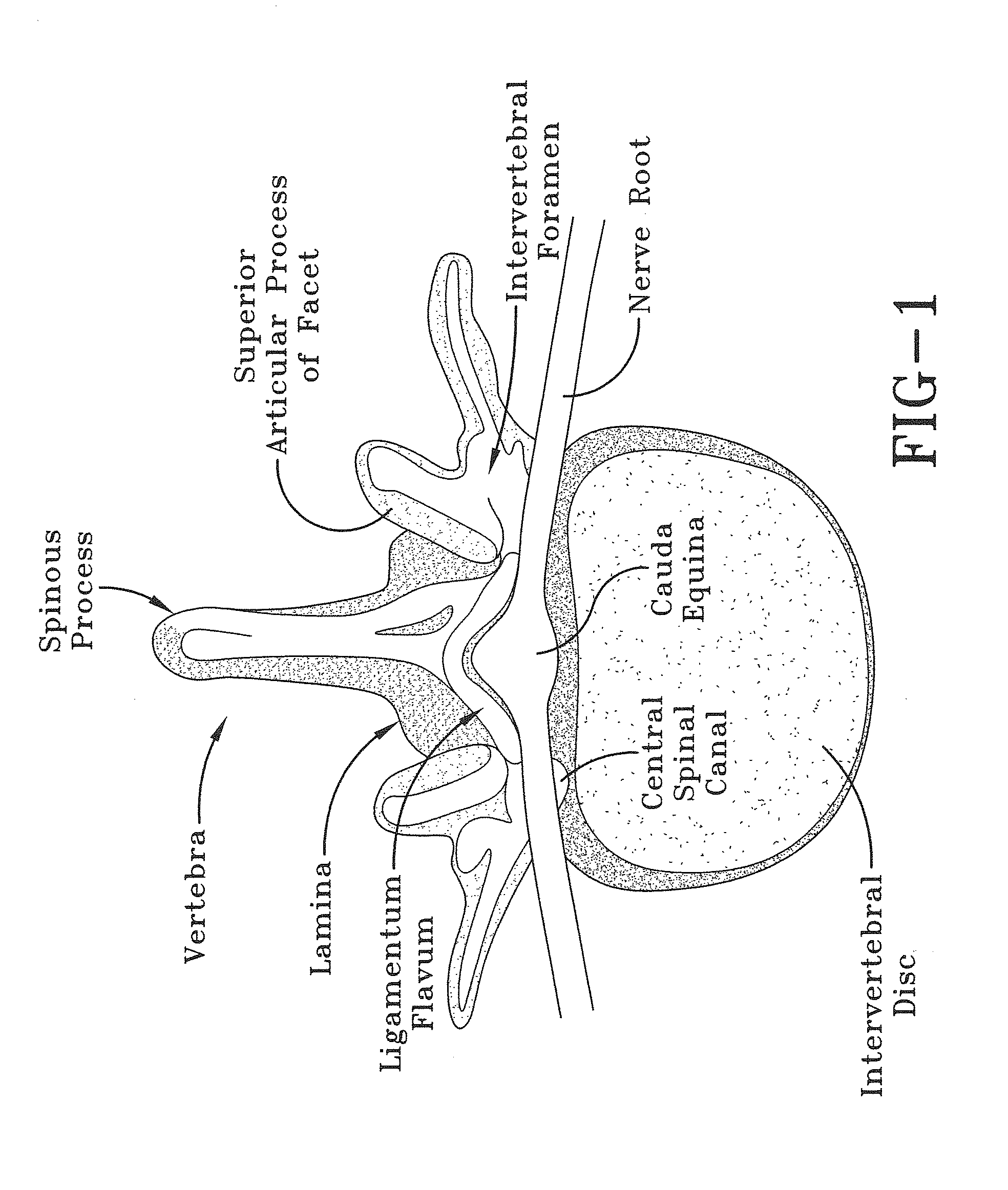 Orifice probe apparatus and a method of use thereof