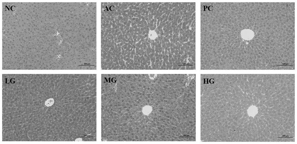 Preparation method of plant functional protein and application of plant functional protein in protection of acute alcoholic liver injury