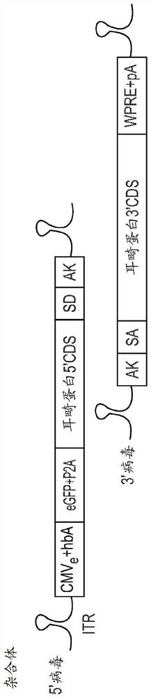 Compositions and methods for treating non-age-associated hearing impairment in a human subject