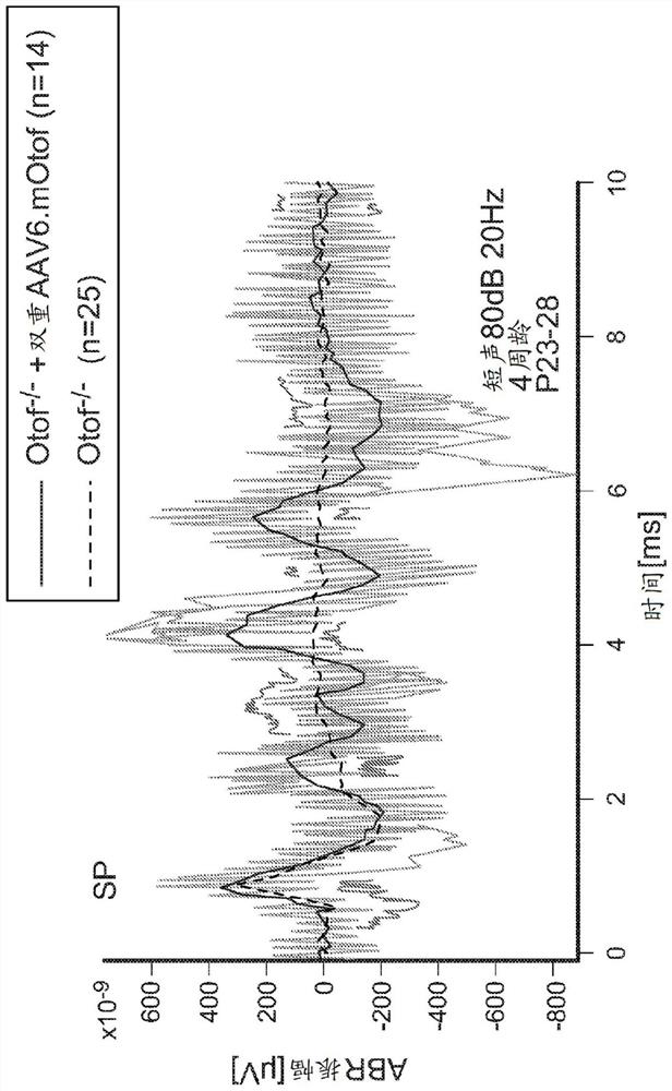 Compositions and methods for treating non-age-associated hearing impairment in a human subject