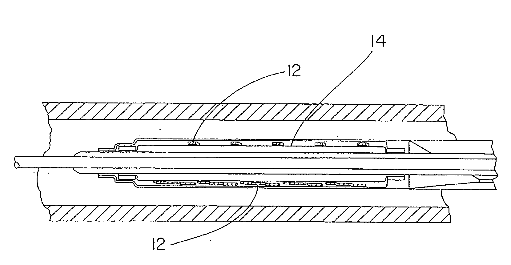 Bioabsorbable Self-Expanding Endolumenal Devices