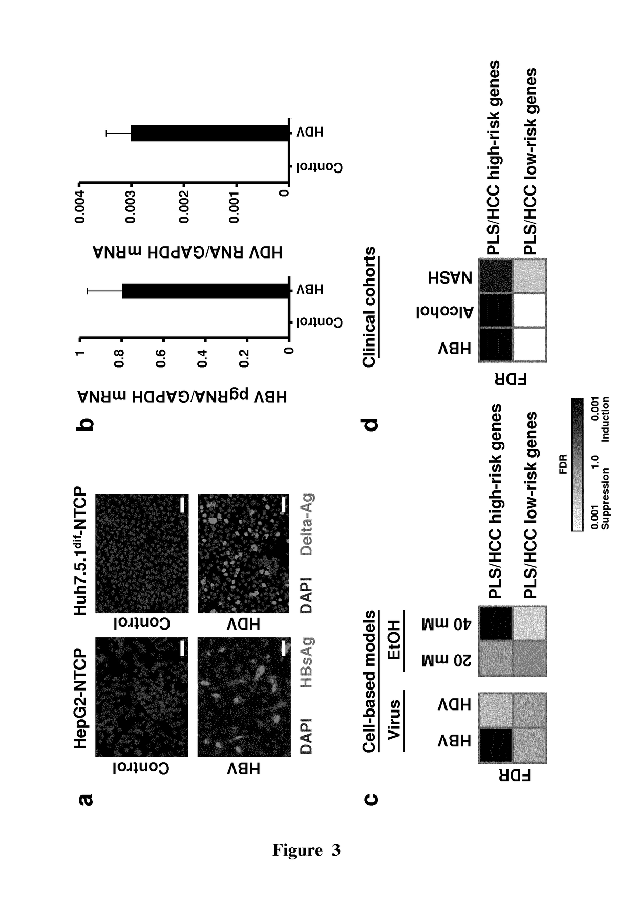 Clinical gene signature-based human cell culture model and uses thereof