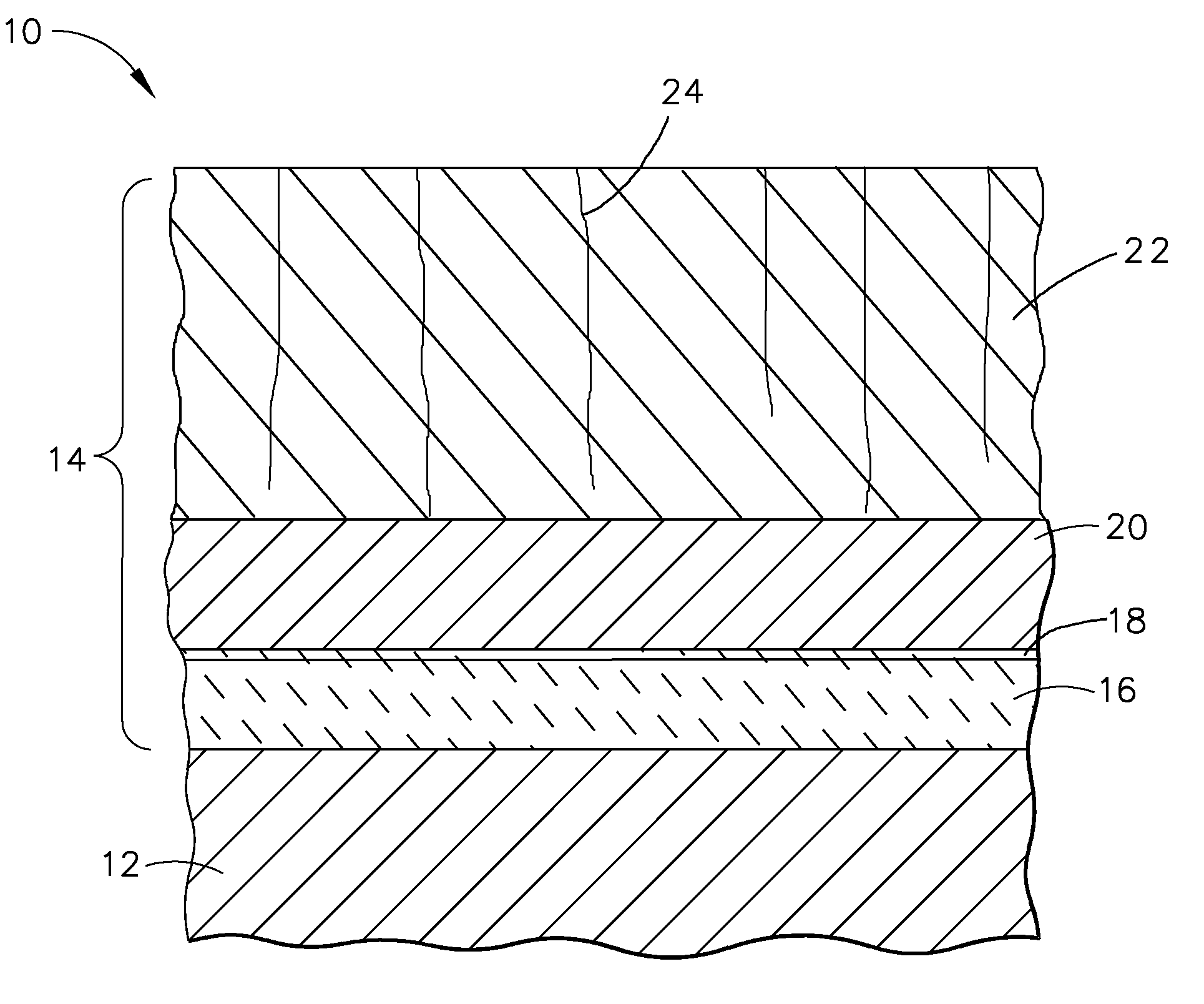 Thermal barrier coating system