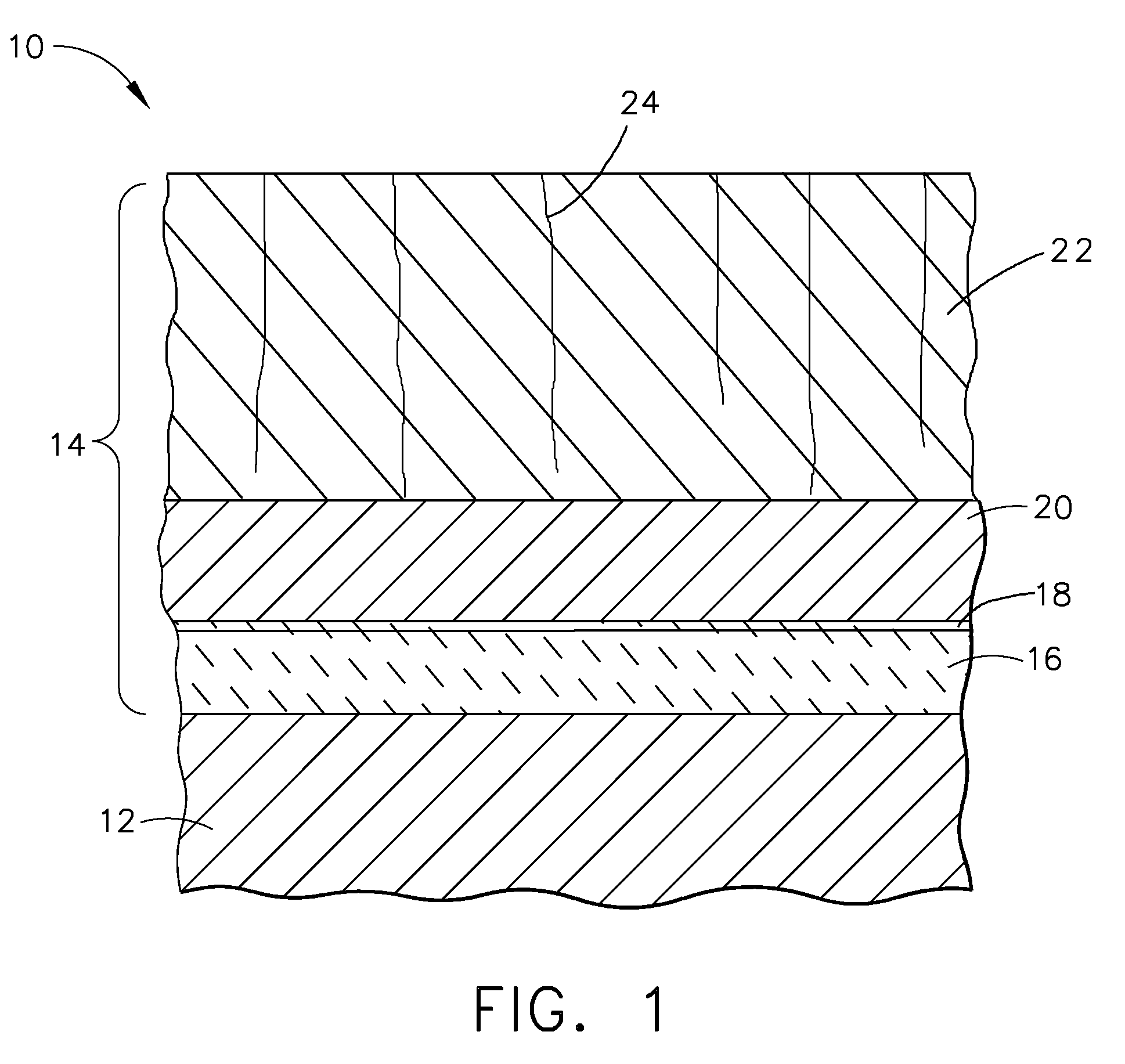 Thermal barrier coating system