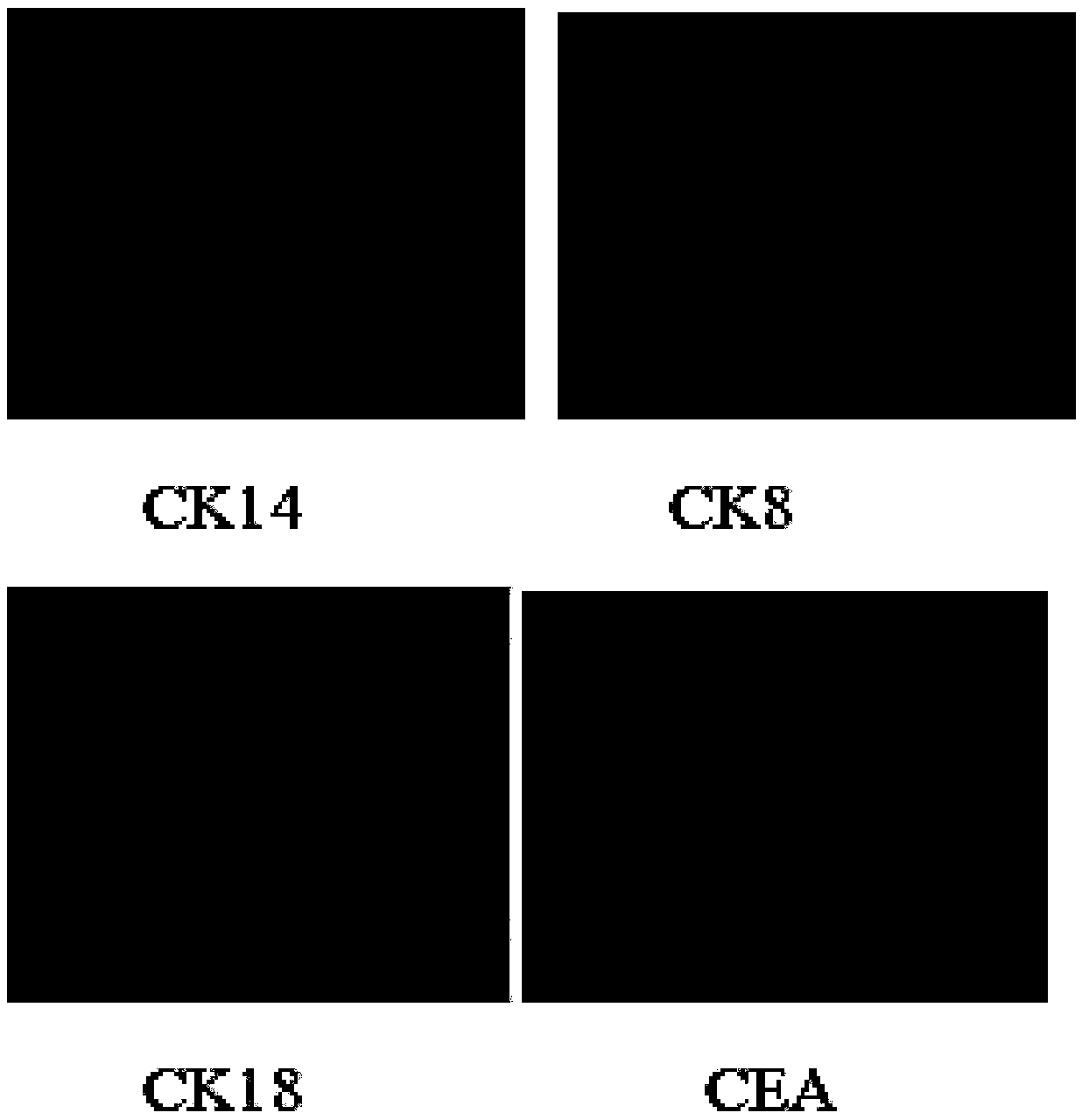 Method for inducing differentiation of sweat gland cells by epidermal stem cells and culture medium group