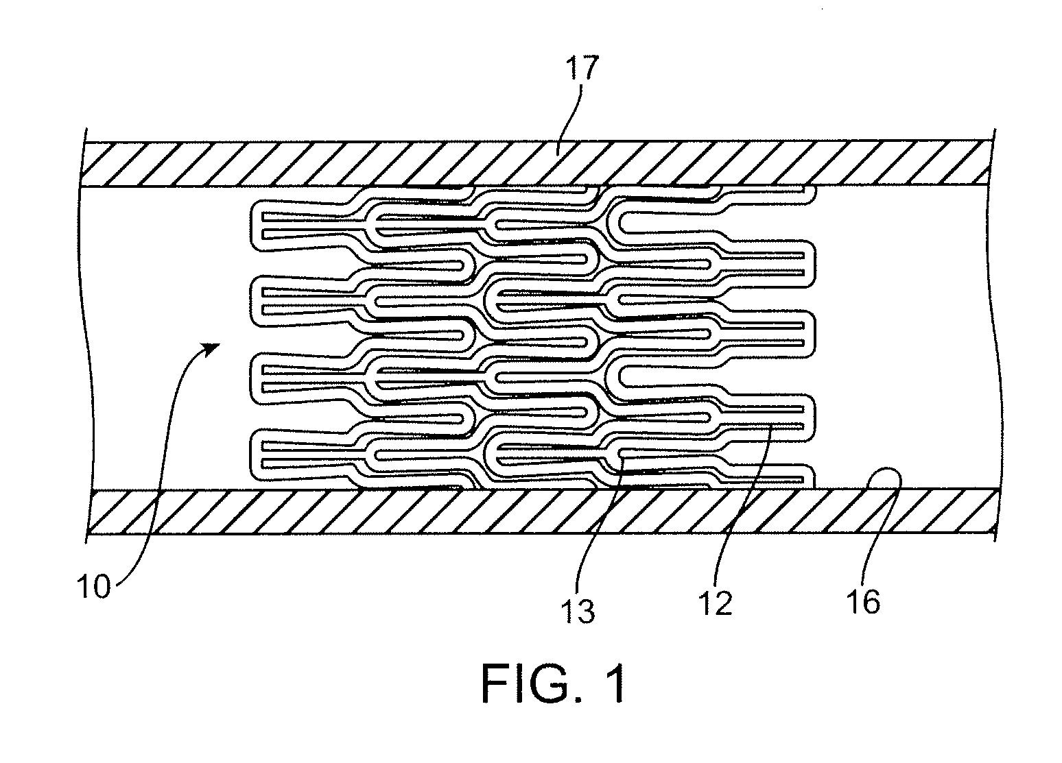 Coated stent and method of making the same