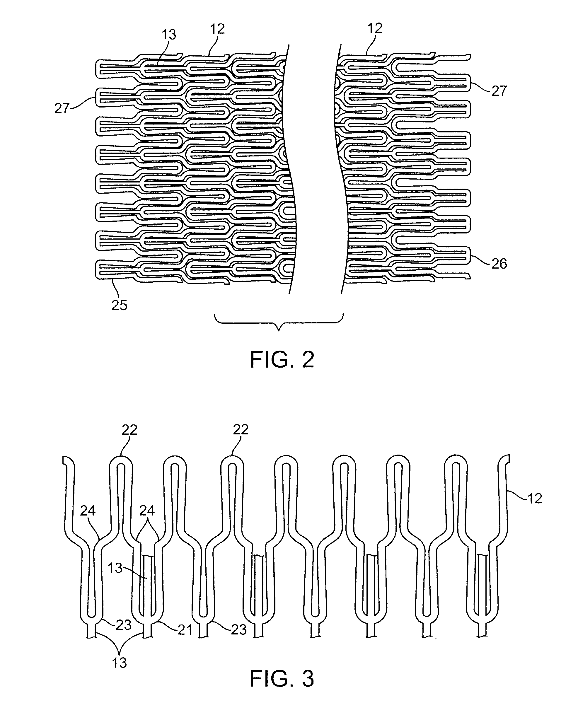 Coated stent and method of making the same