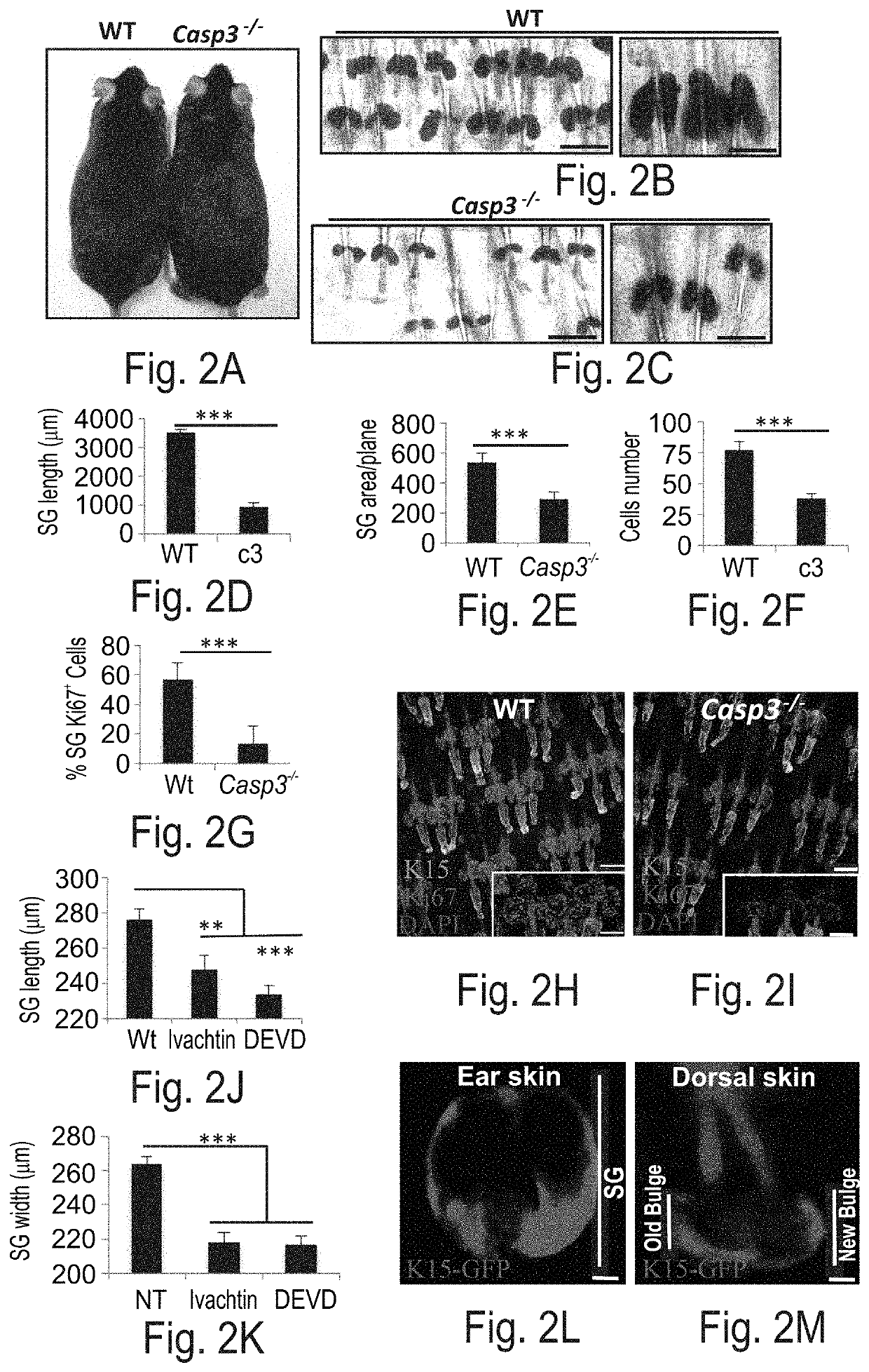 Use of caspase-3 inhibitors and caspase-3 activators in the manufacture of medicament for treating cancer and wound healing