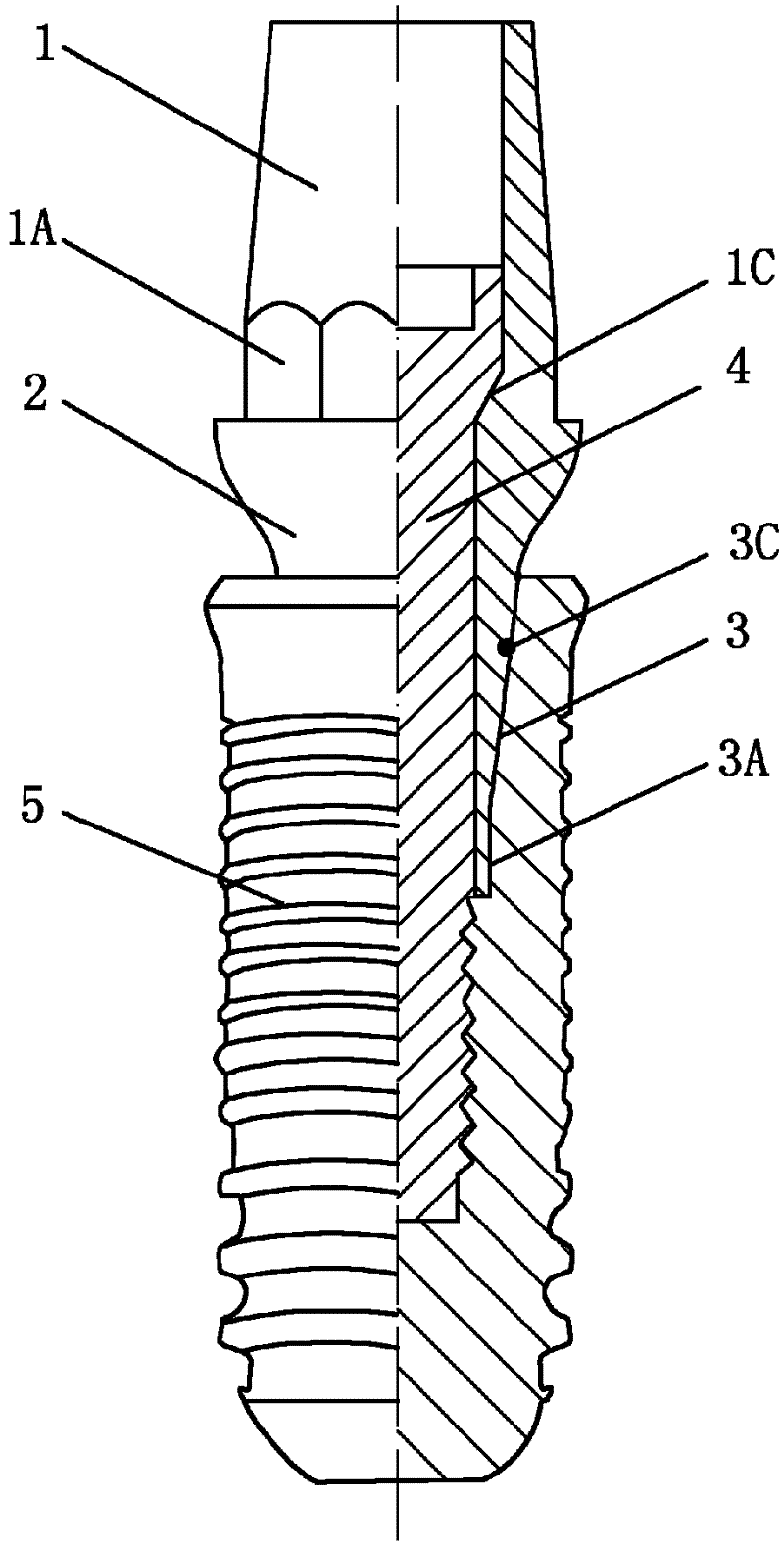 Hollow abutment capable of connecting with interior of dental implant