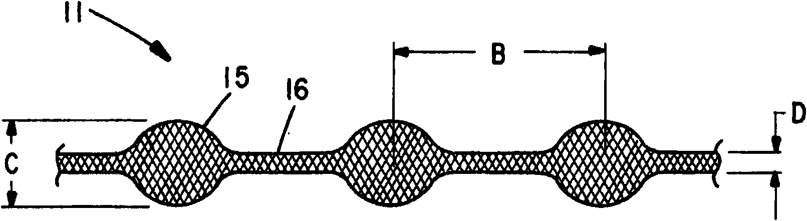 Braided occlusion device having repeating expanded volume segments separated by articulation segments