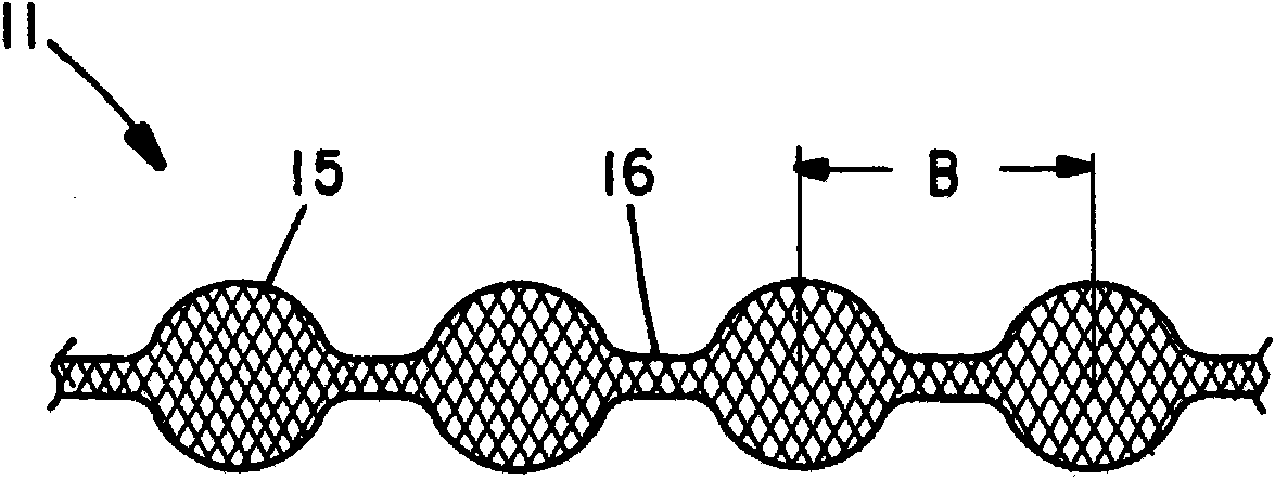 Braided occlusion device having repeating expanded volume segments separated by articulation segments