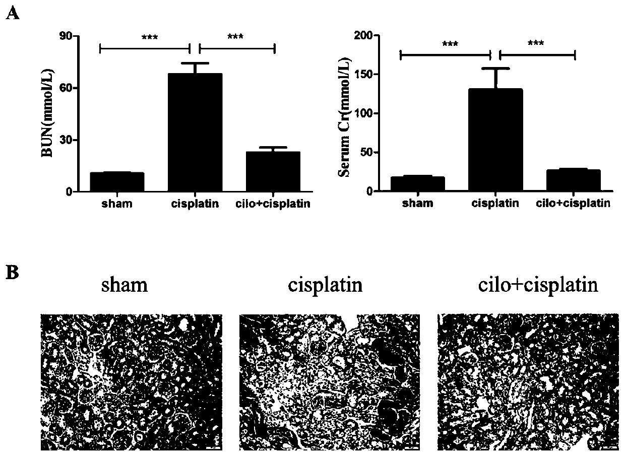 Application of cilomilast in preparation of drug for treating symptoms associated with acute kidney injury