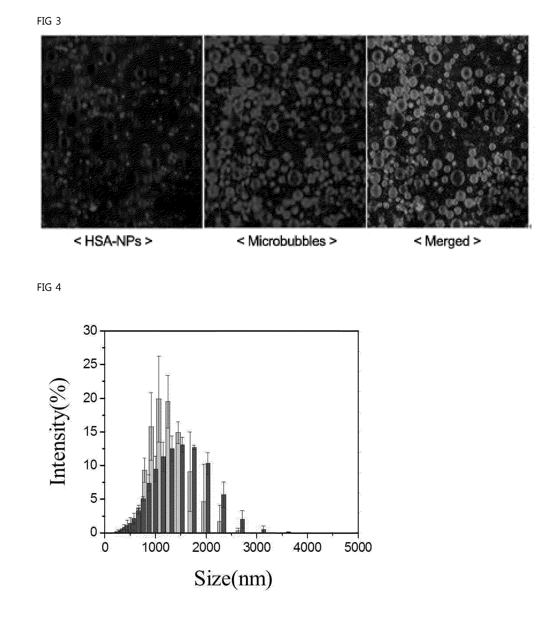 Ultrasound contrast agent with nanoparticles including drug and method for preparing the same