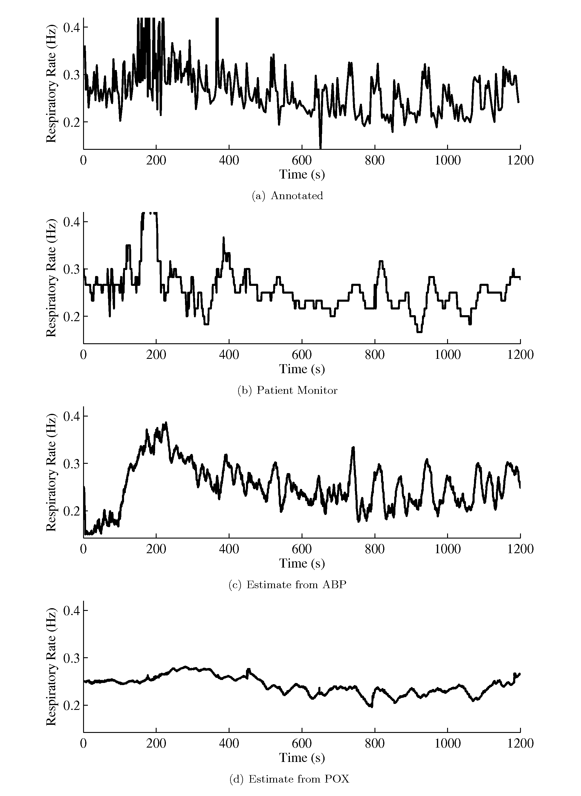 Method, system, and apparatus for cardiovascular signal analysis, modeling, and monitoring