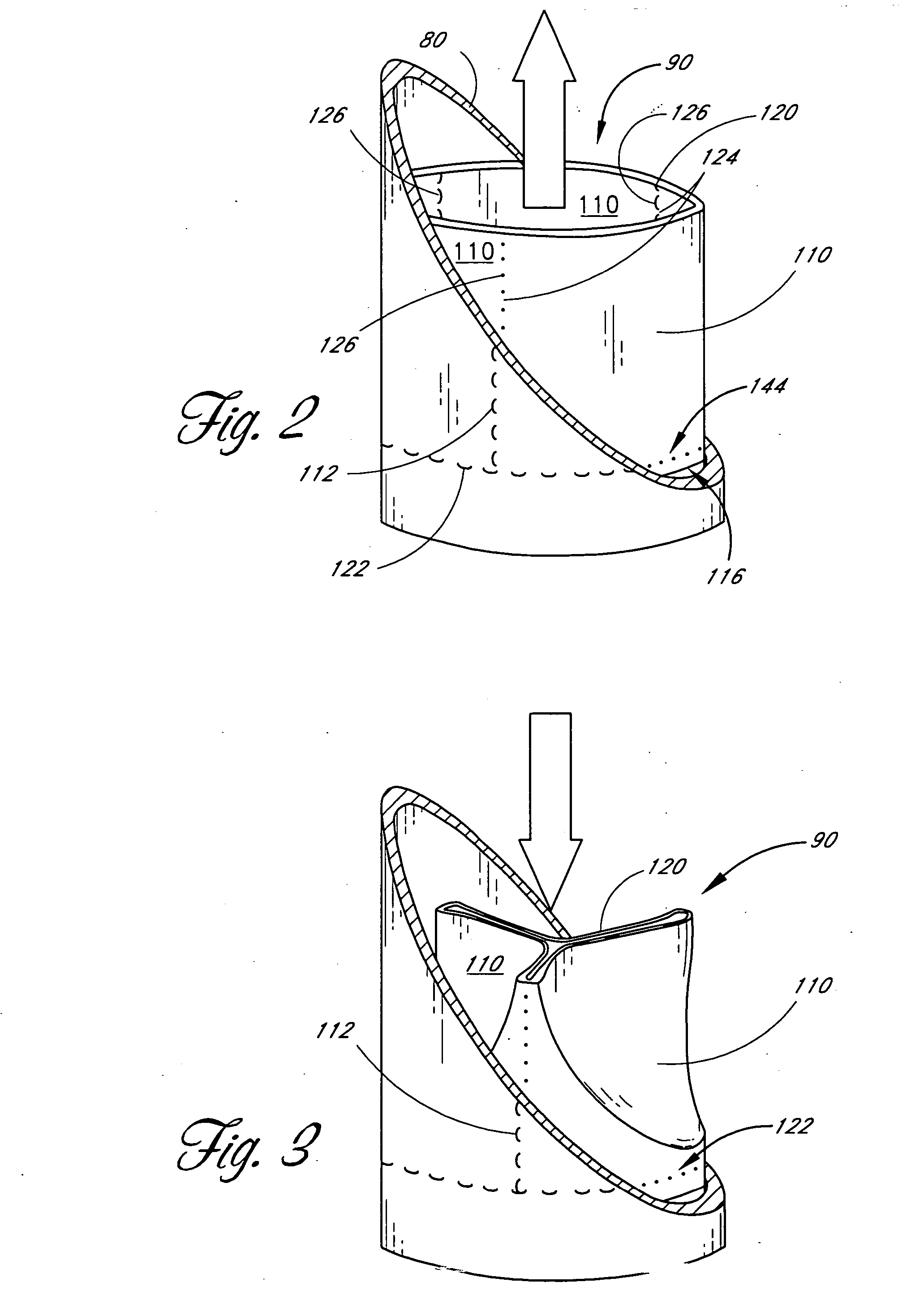 Prosthetic heart valve