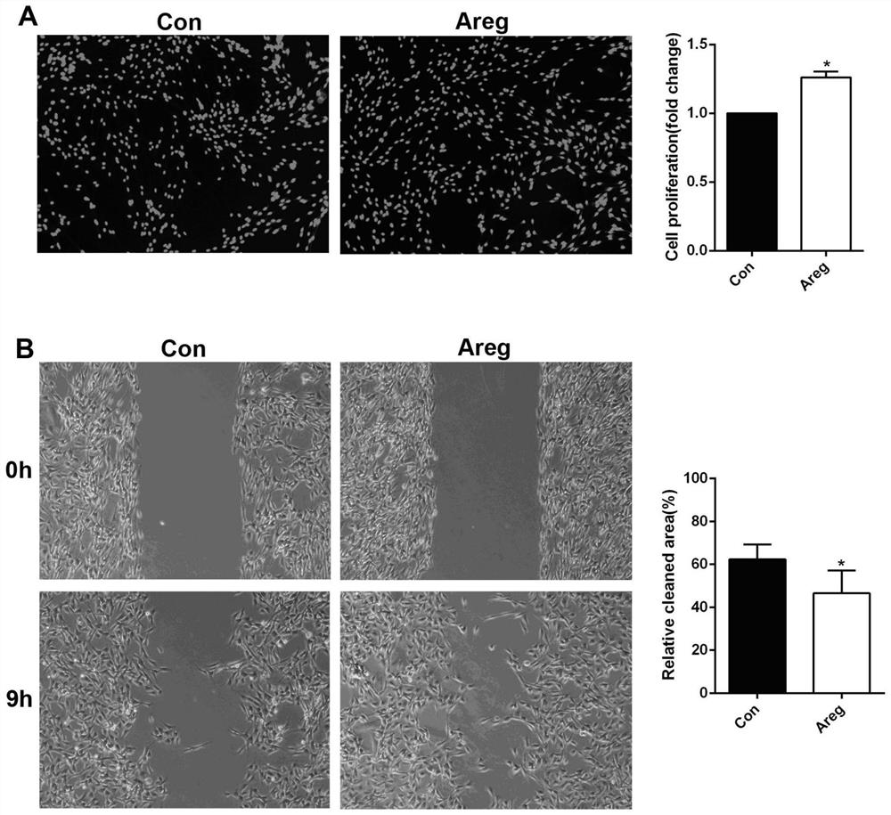 Application of epidermal growth factor Amphiregulin in preparation of Schwann cell regulation drug