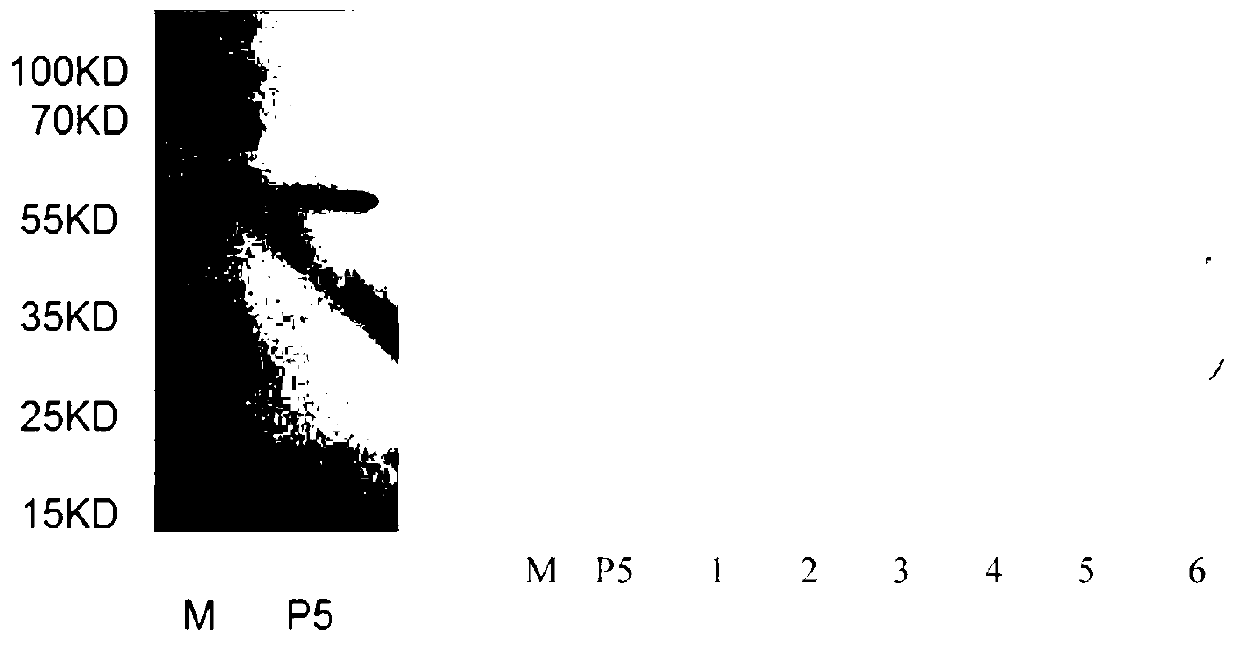 Haemophilus parasuis outer membrane protein P5 (OMP5) resistant monoclonal antibody, hybridoma cell strain and application