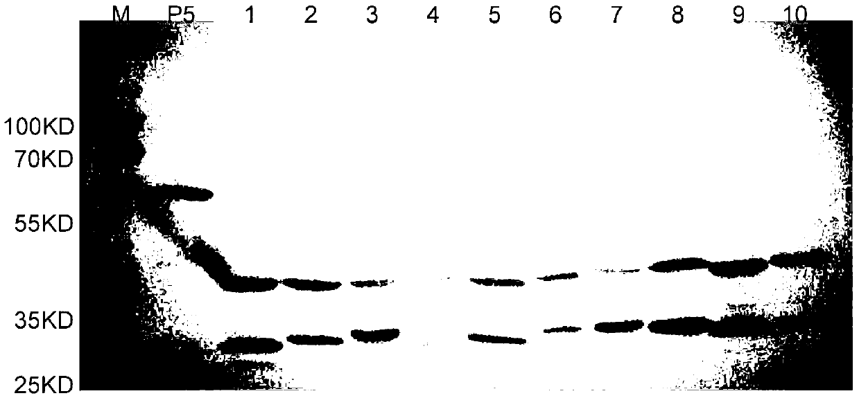 Haemophilus parasuis outer membrane protein P5 (OMP5) resistant monoclonal antibody, hybridoma cell strain and application