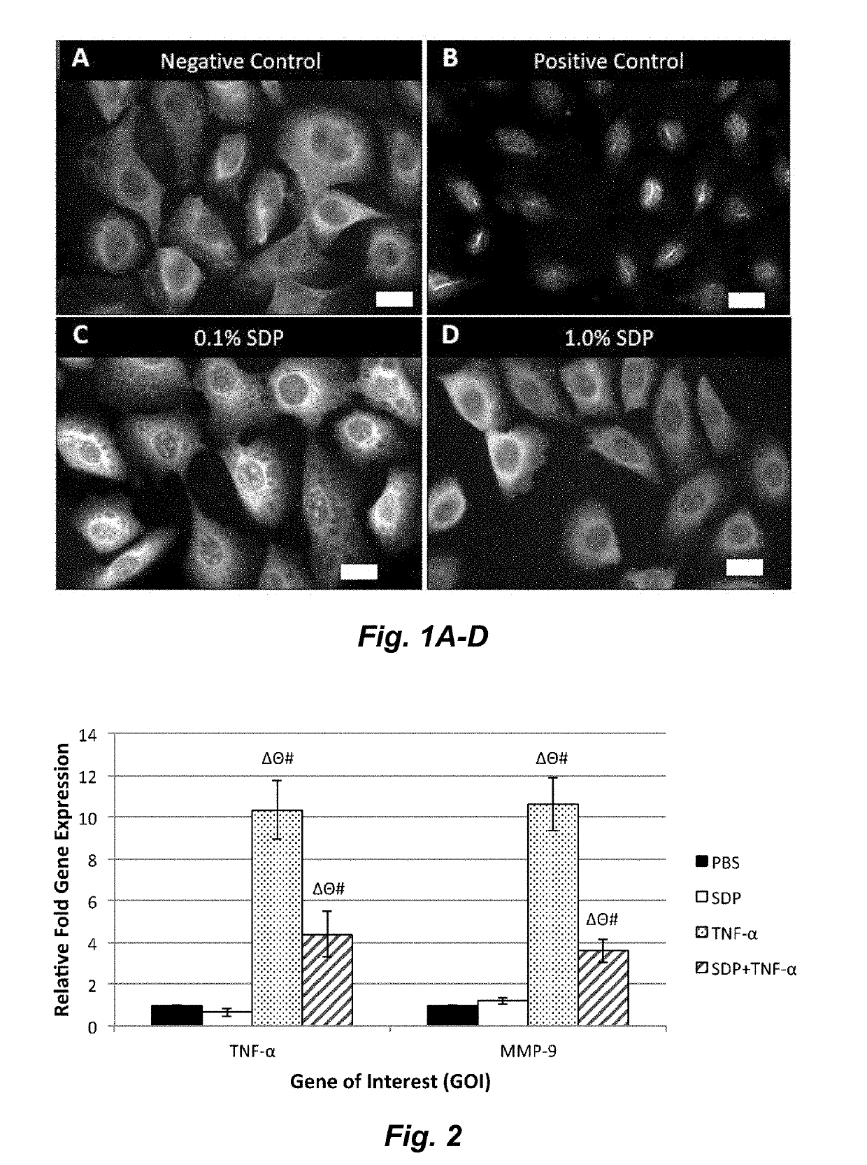 Silk-derived protein for treating inflammation