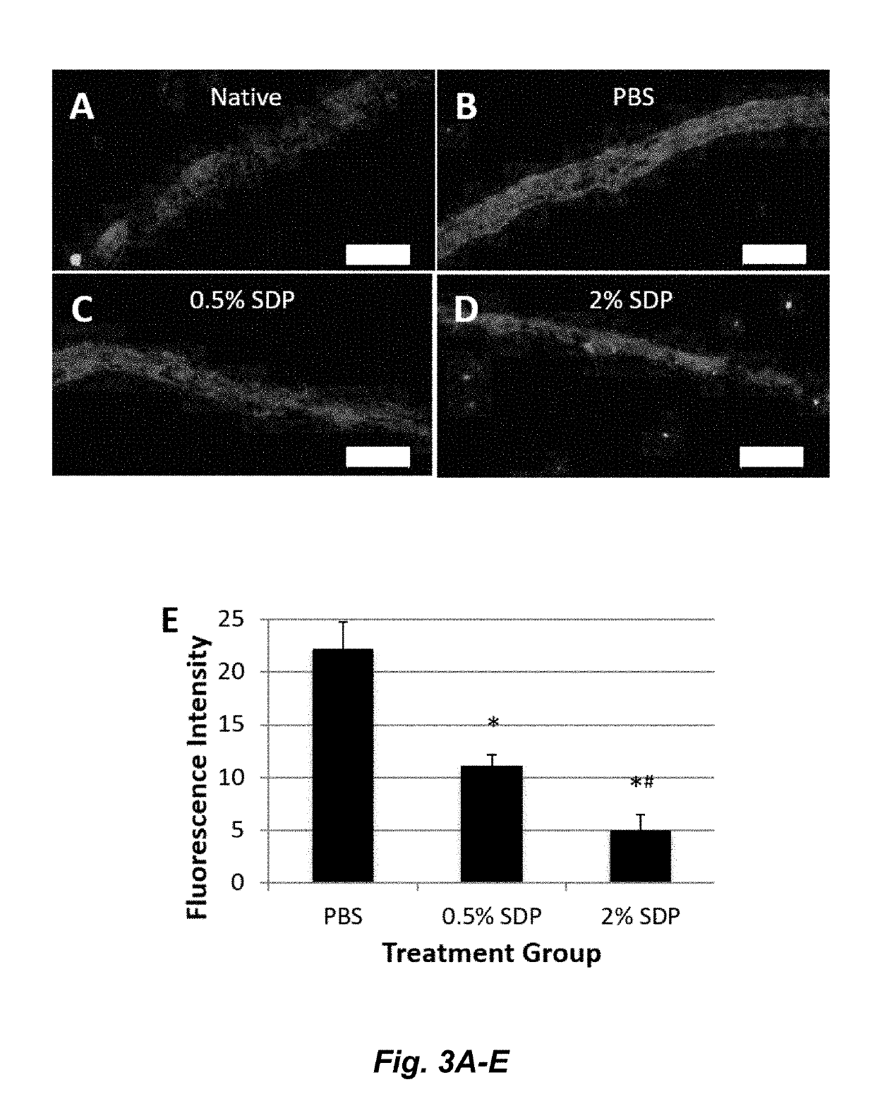 Silk-derived protein for treating inflammation