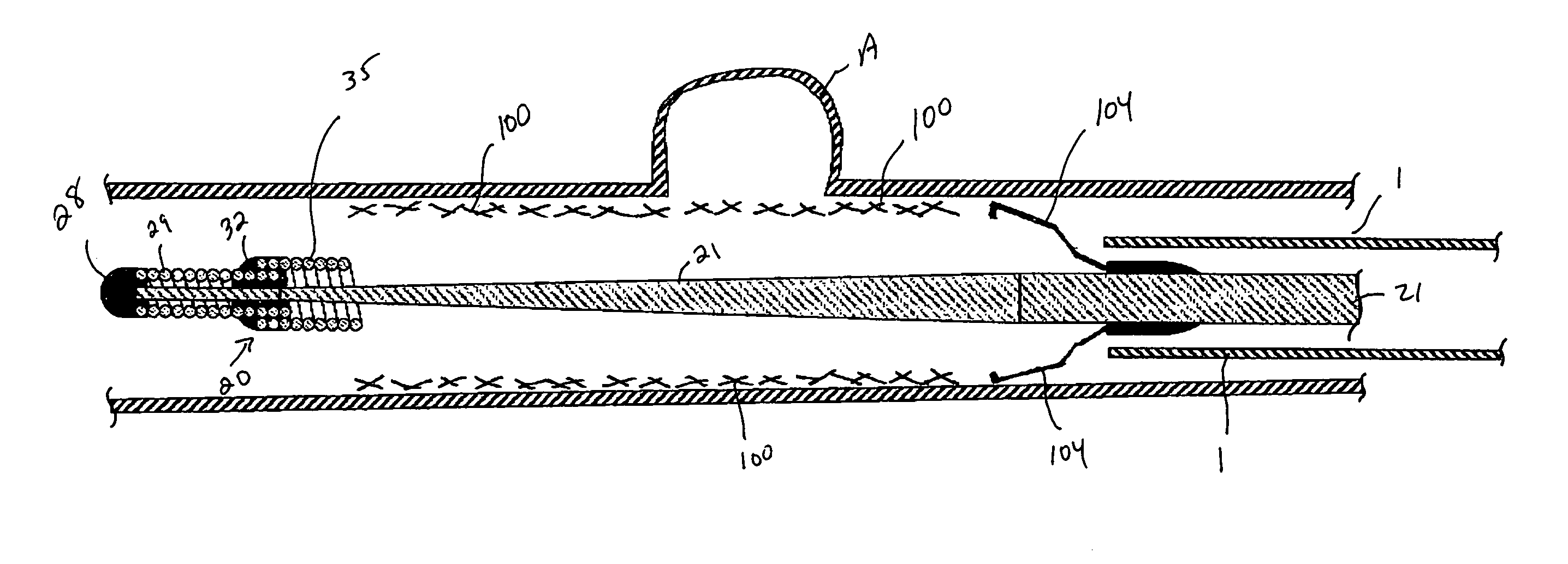 System and method for delivering and deploying an occluding device within a vessel