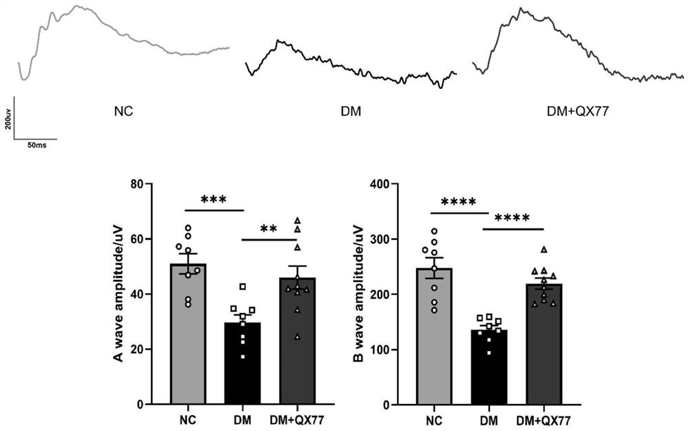 Application of selective autophagy activator QX77 in preparation of medicine for intervening or treating diabetic retinopathy