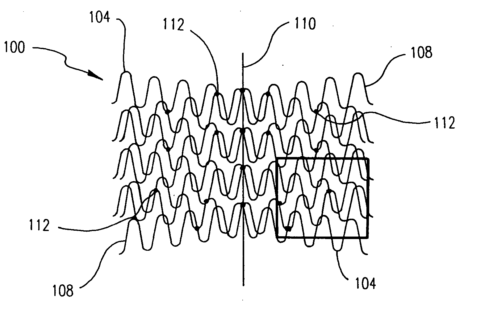 Overlapped stents for scaffolding, flexibility and MRI compatibility