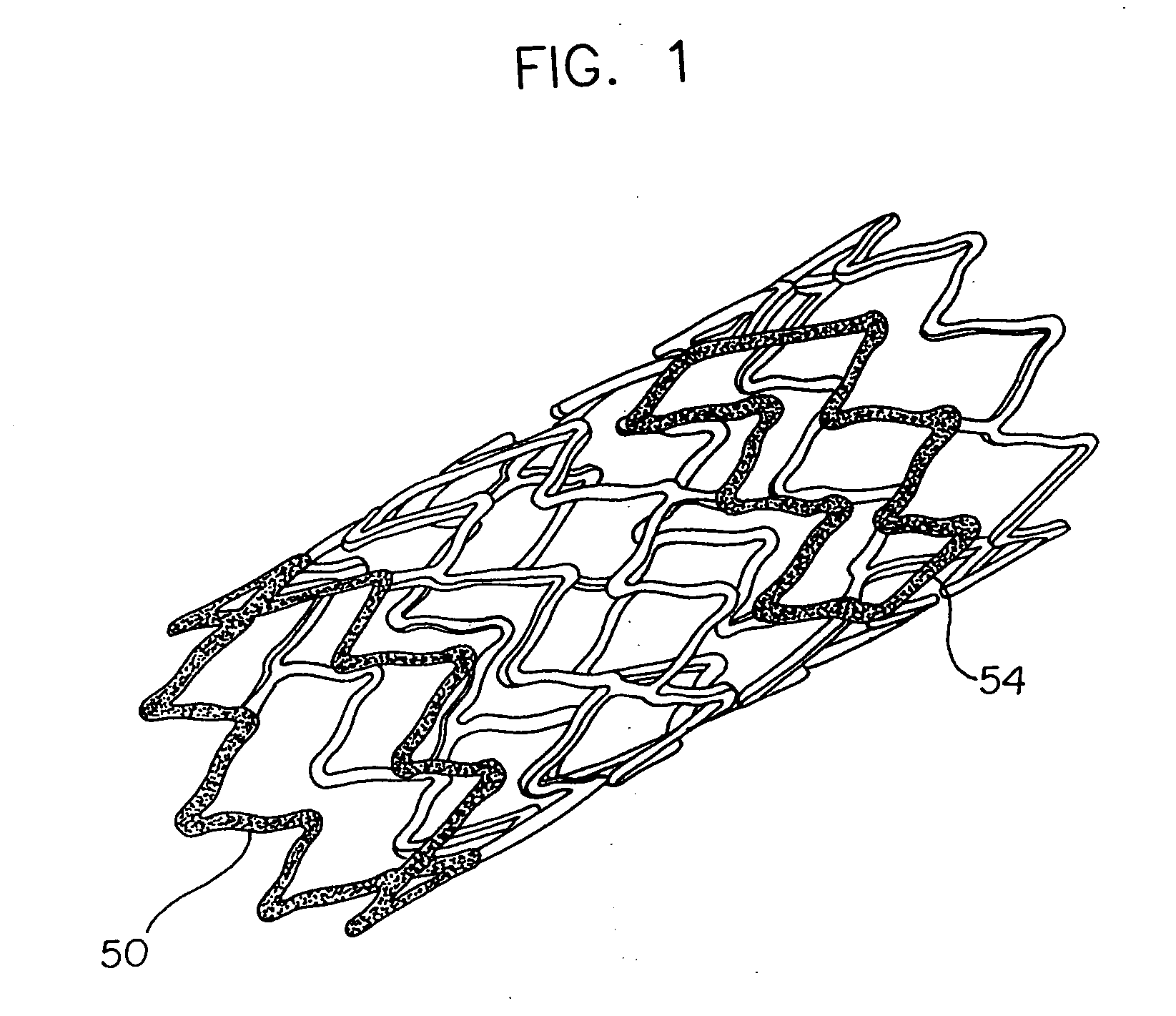 Overlapped stents for scaffolding, flexibility and MRI compatibility