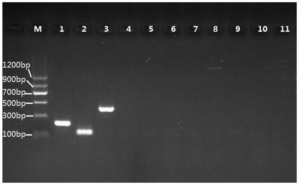 Primer pair combination and kit for detecting and identifying human tissue echinococcosis pathogen