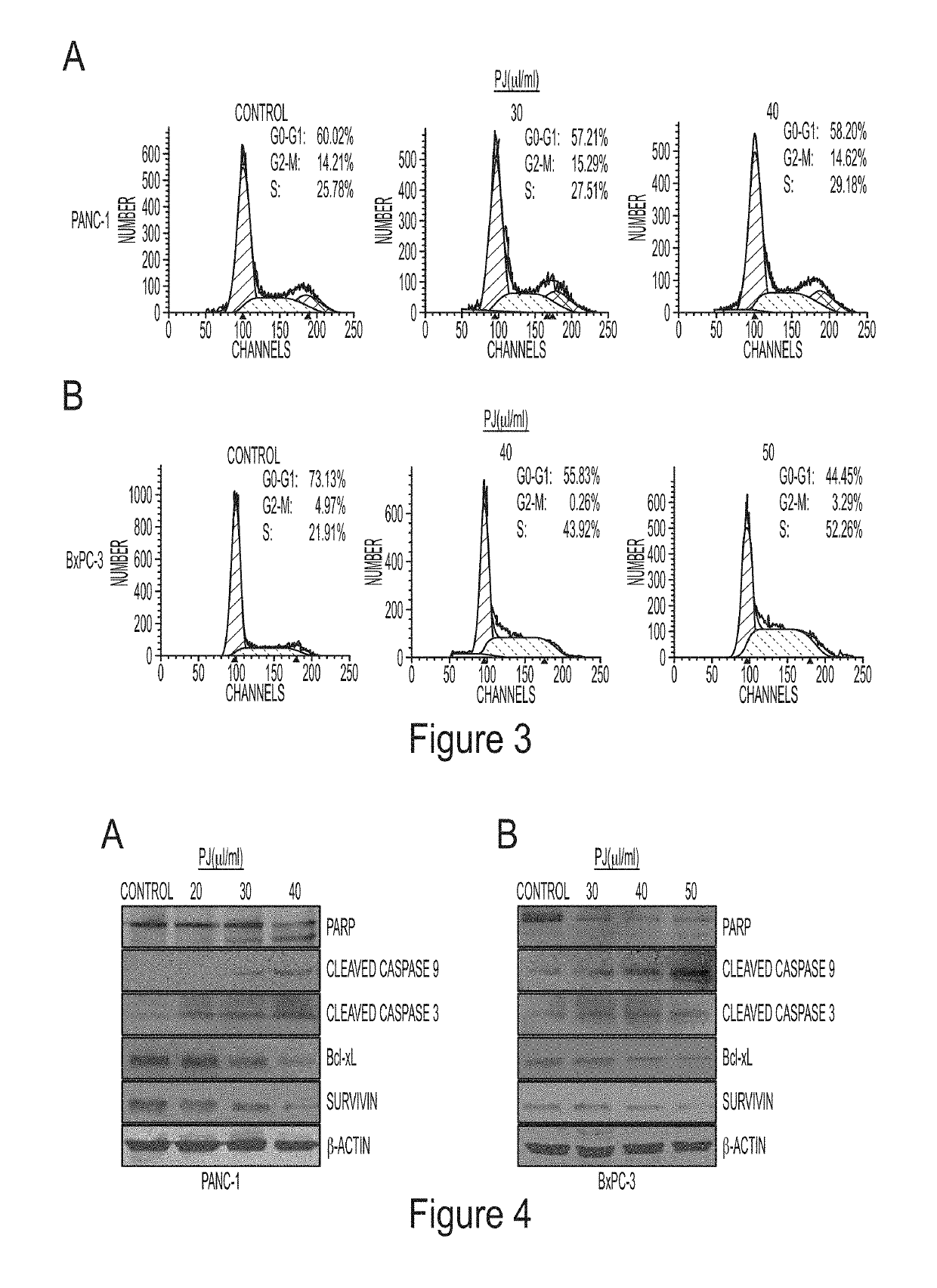 Anti-proliferative effects of palm vegetation liquor and extracts thereof in preventing pancreatic cancer