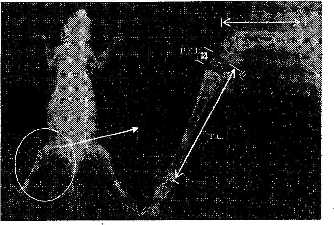 Growth-enhancing yeast hydrolysate and health food comprising the same