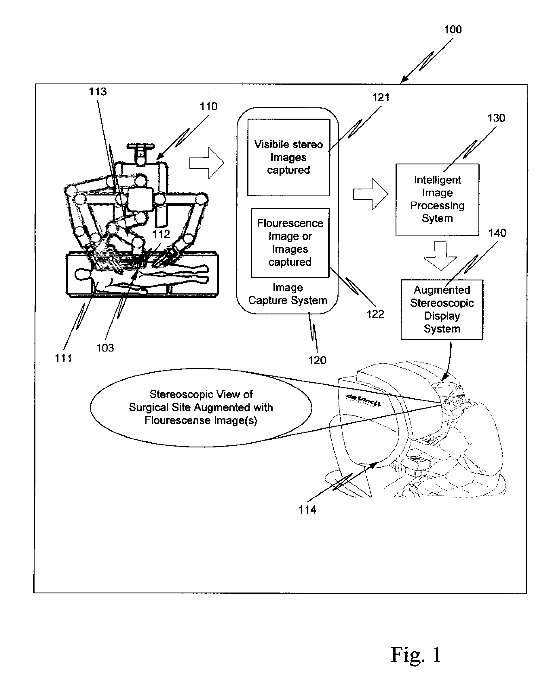 Augmented stereoscopic visualization for a surgical robot using a camera unit with a modified prism