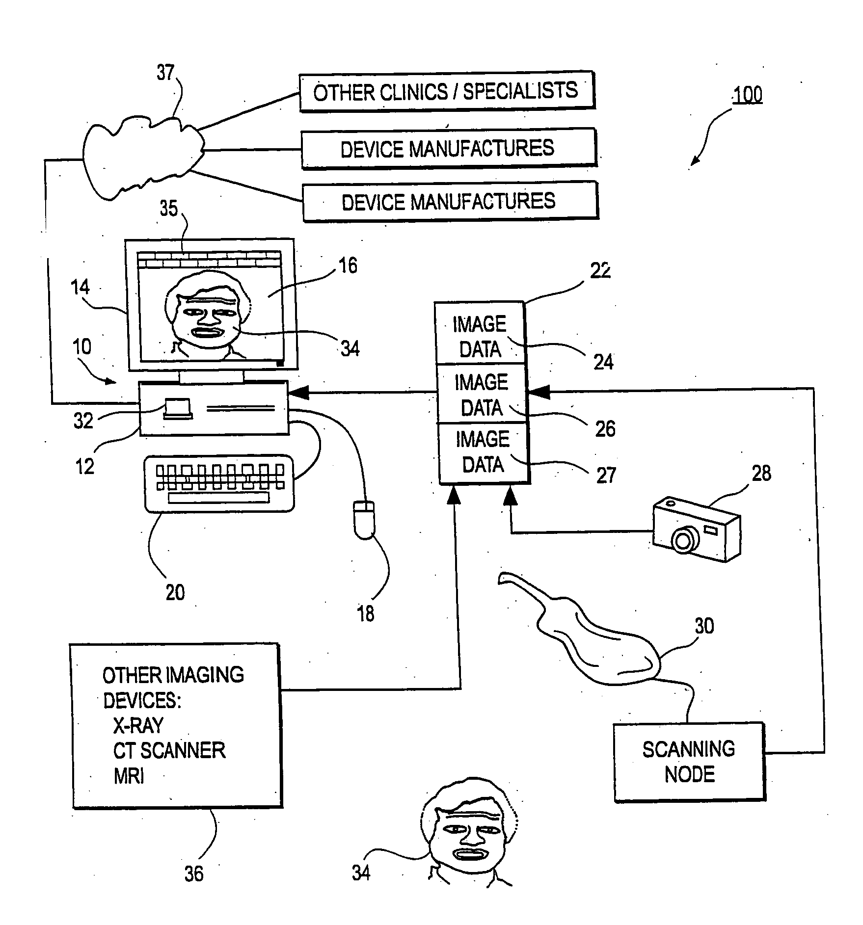 Method and system for measuring tooth displacements on a virtual three-dimensional model