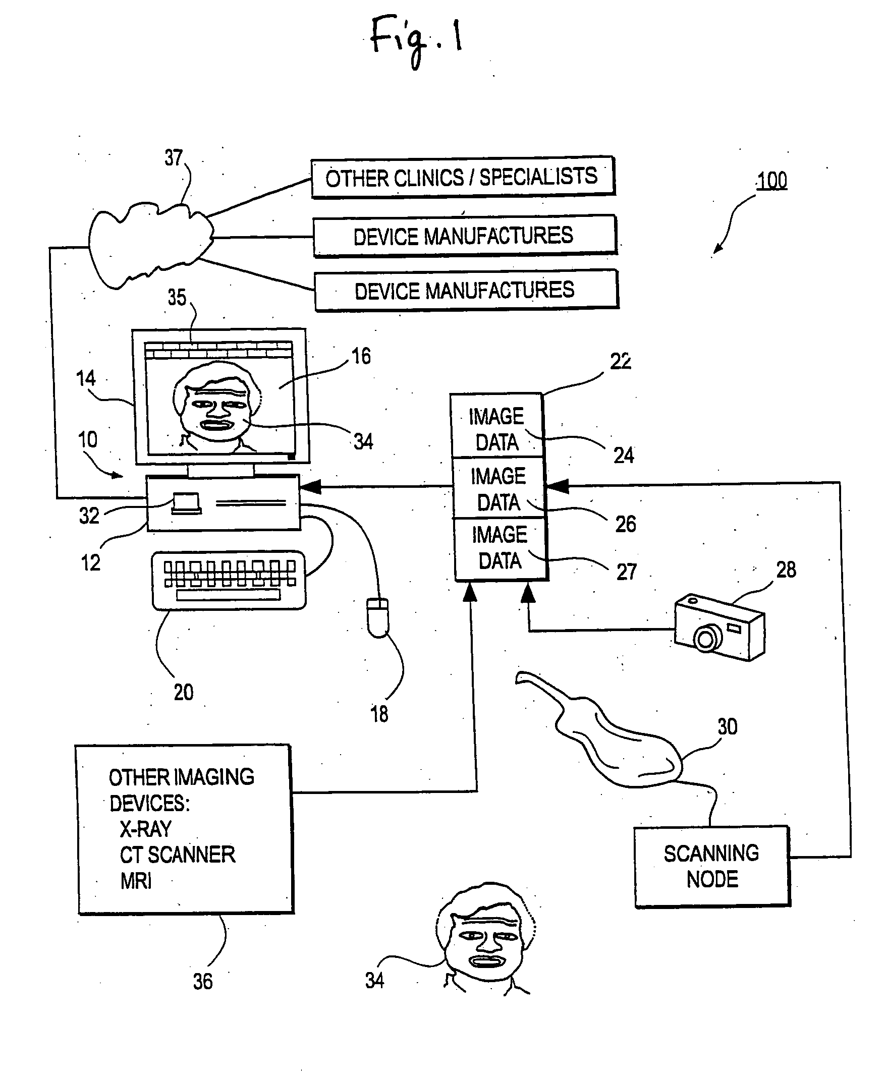 Method and system for measuring tooth displacements on a virtual three-dimensional model