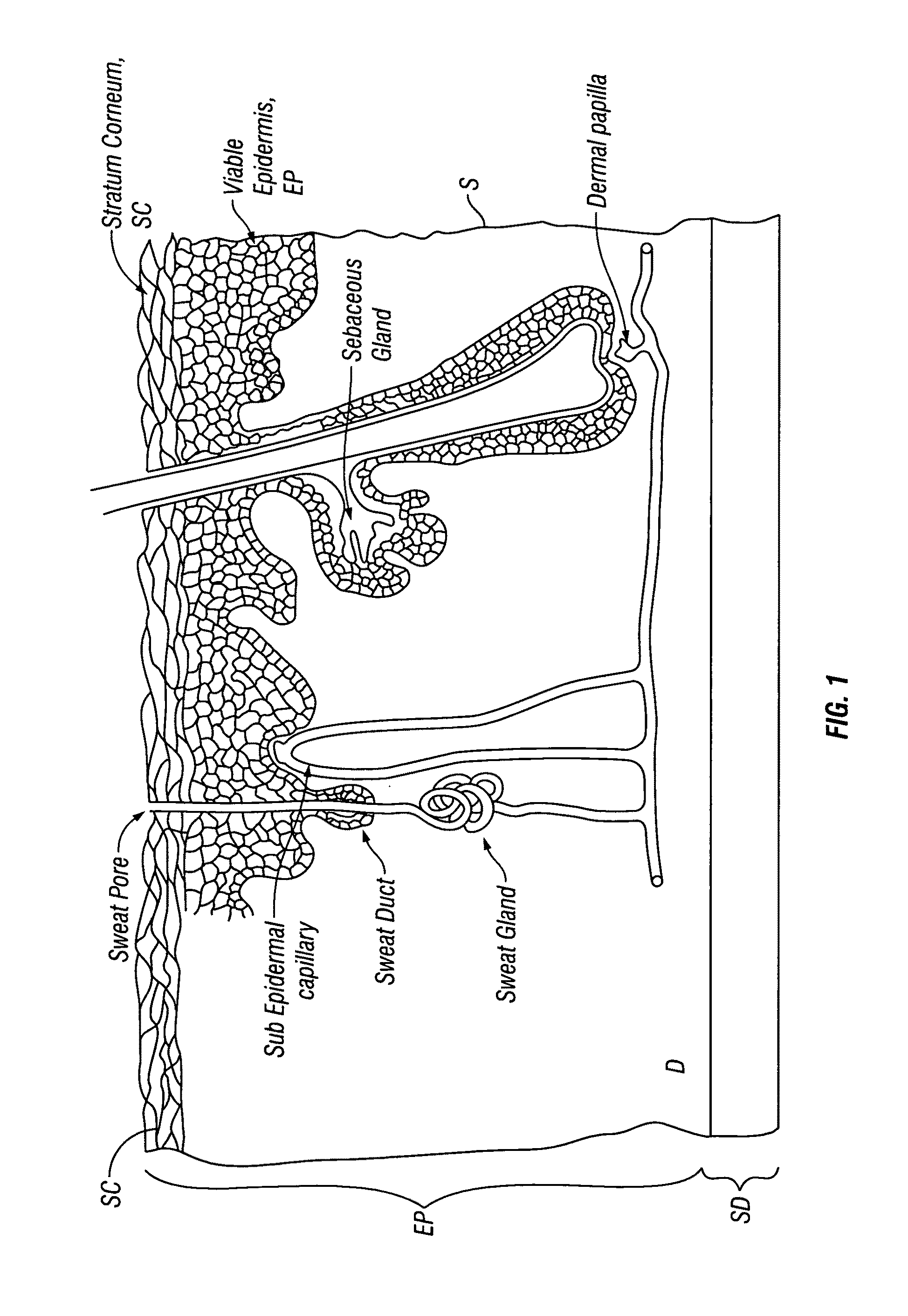 Patches and method for the transdermal delivery of a therapeutically effective amount of iron