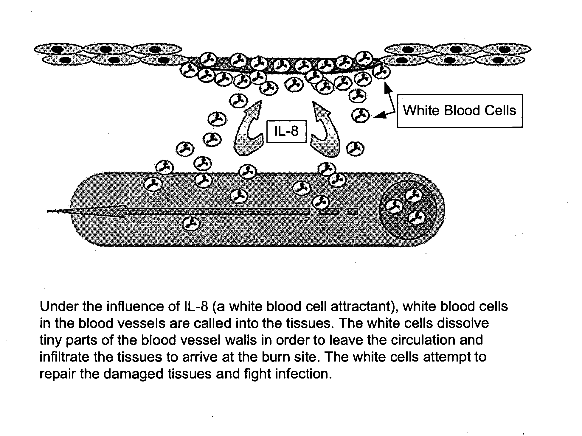 Compositions and Methods for Treating Burns