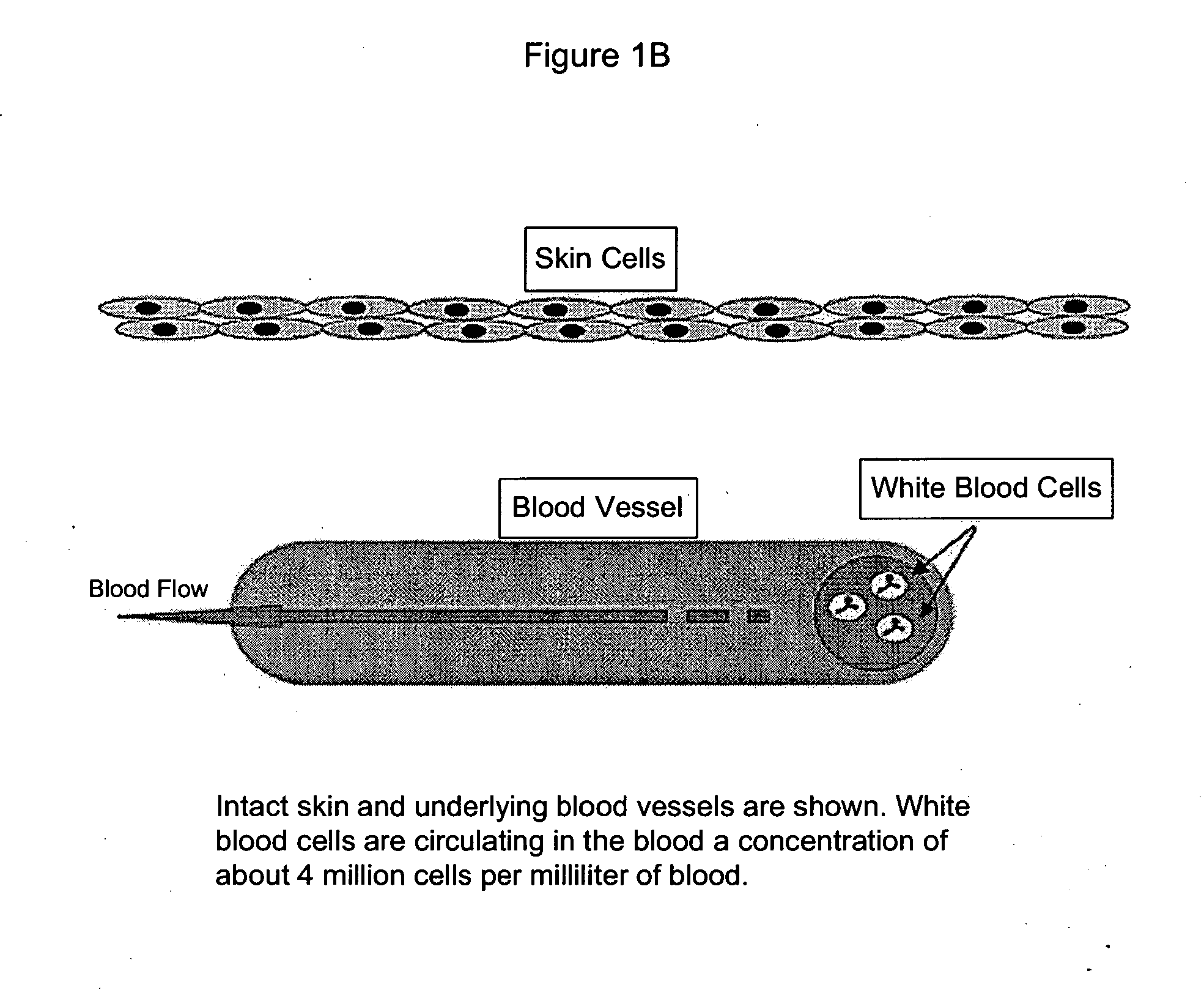 Compositions and Methods for Treating Burns