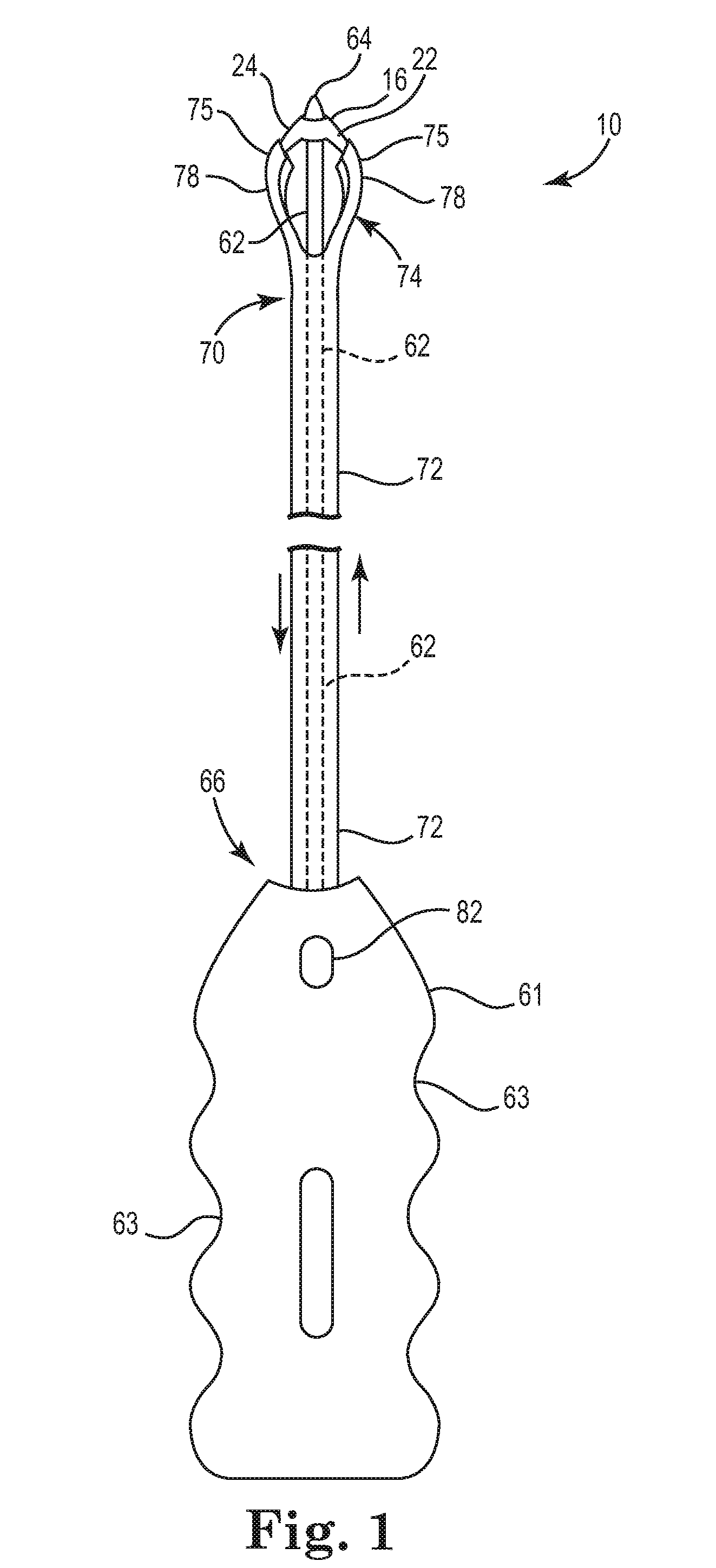 Pelvic implant and delivery system